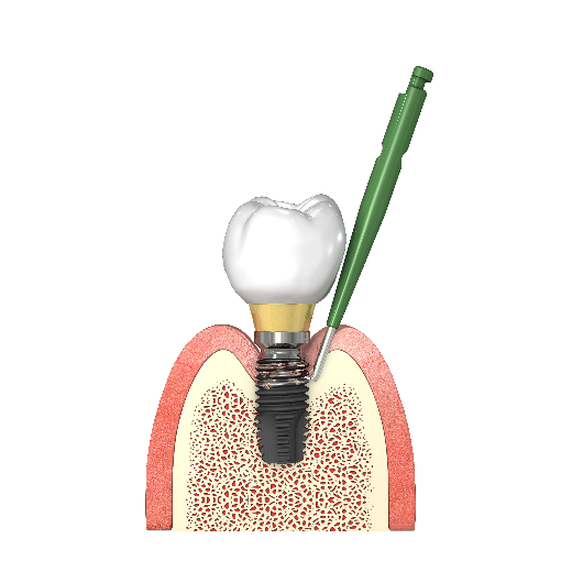 i-Brush2