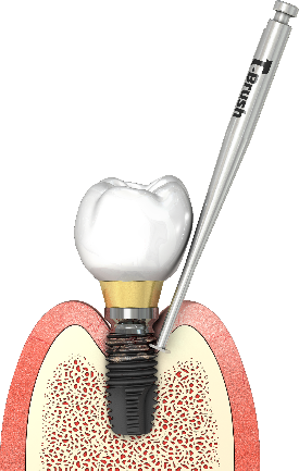 T-brush