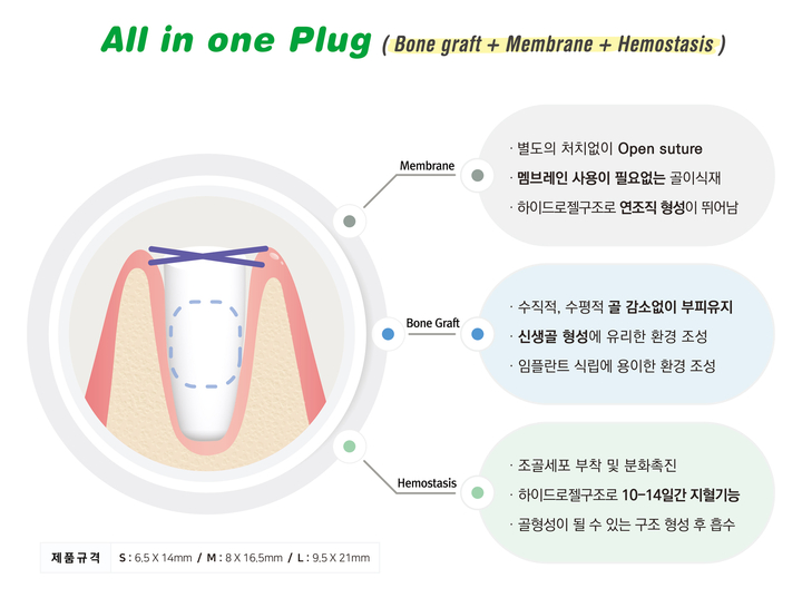 아이비덴탈이 자사의 발치와 보존술 전용 골이식재인 ‘OssPLUG’가 개원가 입소문을 타고 있다고 밝혔다.<아이비덴탈 제공>