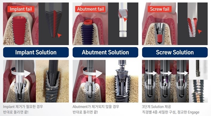 메가젠이 해당 제품은 3단계 솔루션으로 호환성, 편의성을 높였다고 밝혔다.<메가젠 제공>