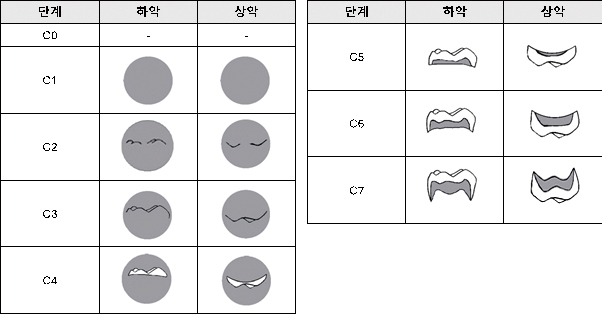 그림1. 다근치의 치관 발생 단계별 모식도