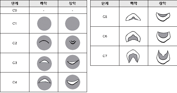 그림2. 단근치의 치관 발생 단계별 모식도