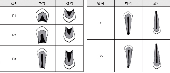 그림4. 단근치의 치근 발생 단계별 모식도