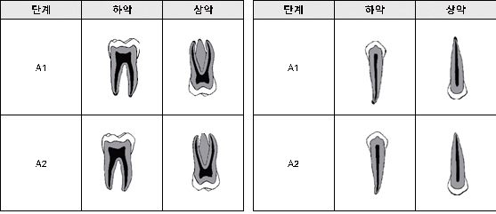그림 5. 치근단의 발생 단계별 모식도(좌: 다근치, 우: 단근치)