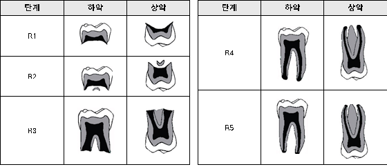 그림3. 다근치의 치근 발생 단계별 모식도