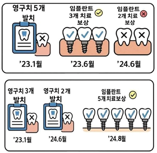 임플란트 연간 보장한도를 초과할 경우(위), 초과하지 않을 경우(아래) <임플란트 치료 보장 예시>