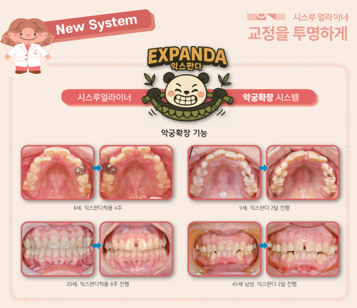 시스루테크가 리브랜딩한 익스판다.