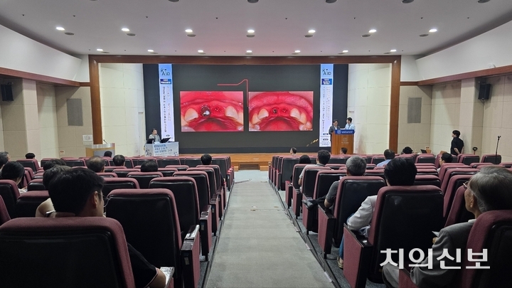 대한치과이식임플란트학회 학술집담회가 지난 9일 서울대 치과병원 8층 한화홀에서 진행됐다.<정현중 기자>