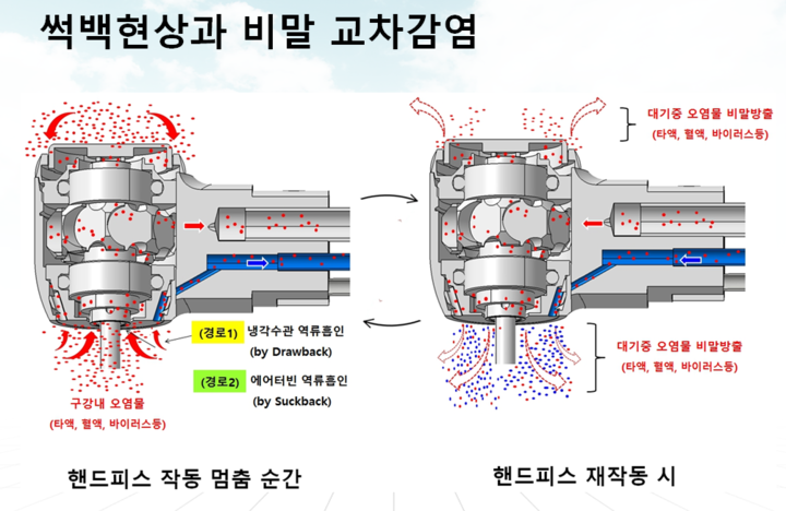 제61차 국제표준화기구 치과용 의료기기분야 기술위원회 총회(ISO/TC 106)가 오는 9월 개최를 앞둔 가운데, 우리나라가 주도하는 치과 핸드피스 감염 관리 기술인 ‘썩백(Suck-back, 역류)’ 현상 차단 시험법 표준화 작업이 주목받고 있다. 사진은 썩백현상 발생 핸드피스 모식도.<두나미스덴탈>