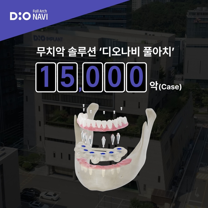 디오의 풀 디지털 무치악 솔루션 ‘디오나비 풀아치(DIO NAVI Full Arch)’가 누적 1만 5000악을 돌파하며 임상가들의 큰 관심을 받고 있다.<디오 제공>