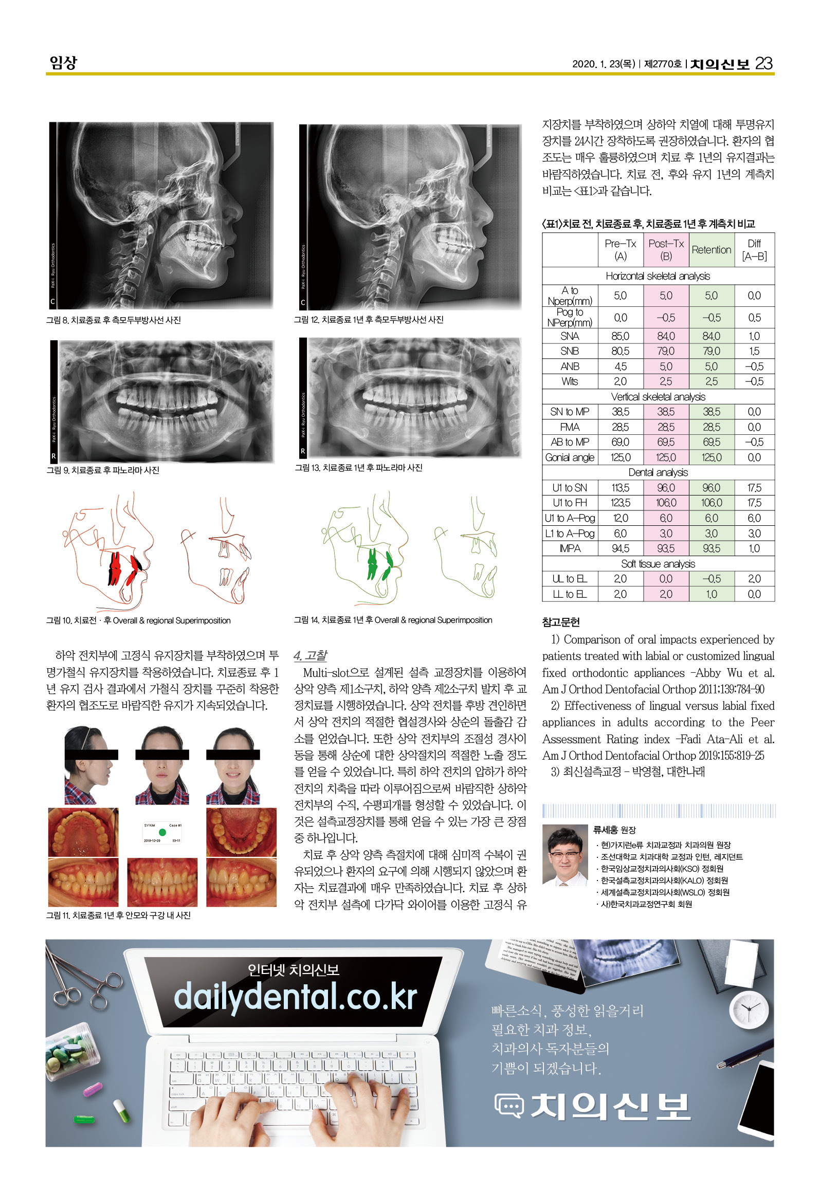 류세홍2