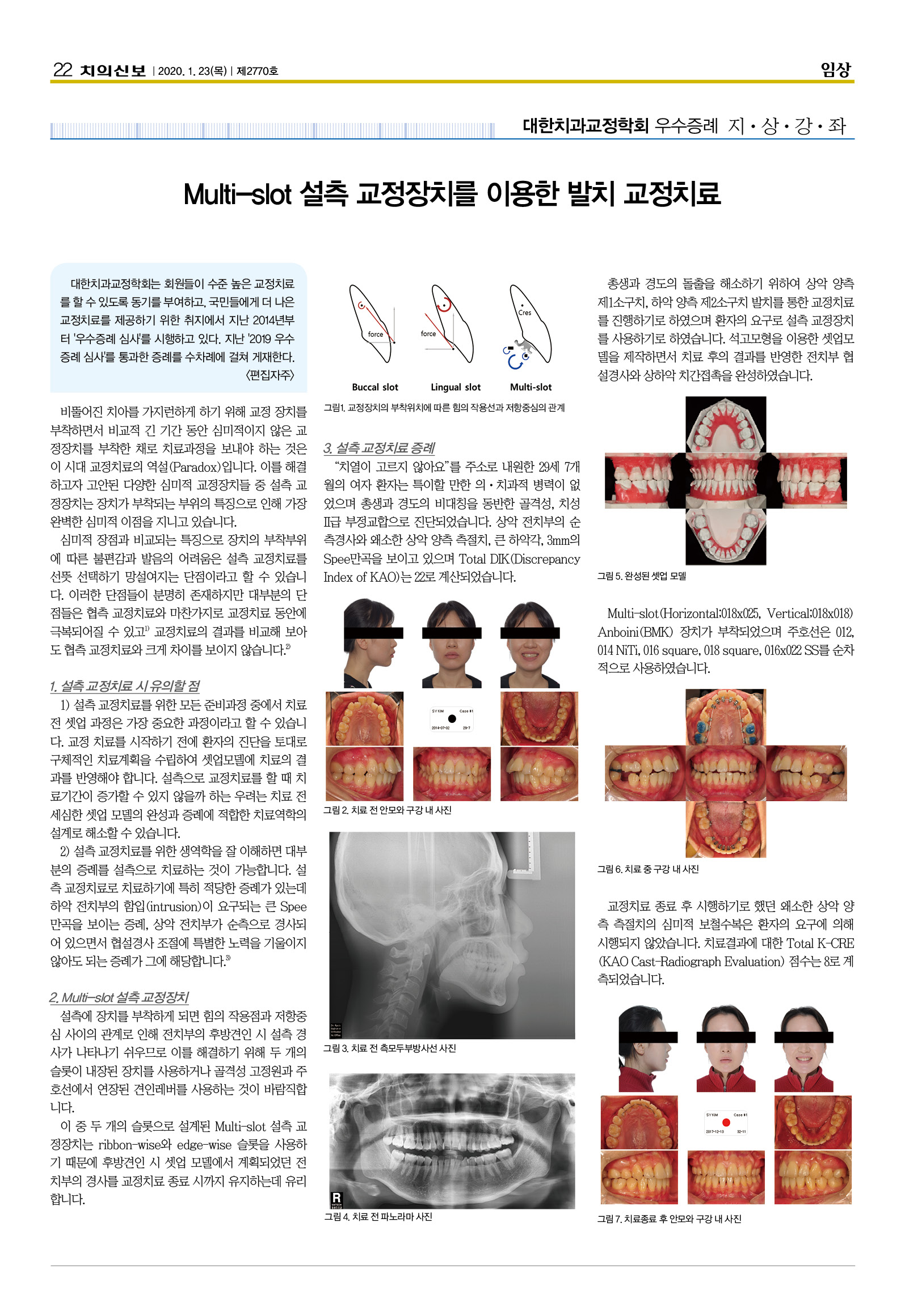 류세홍