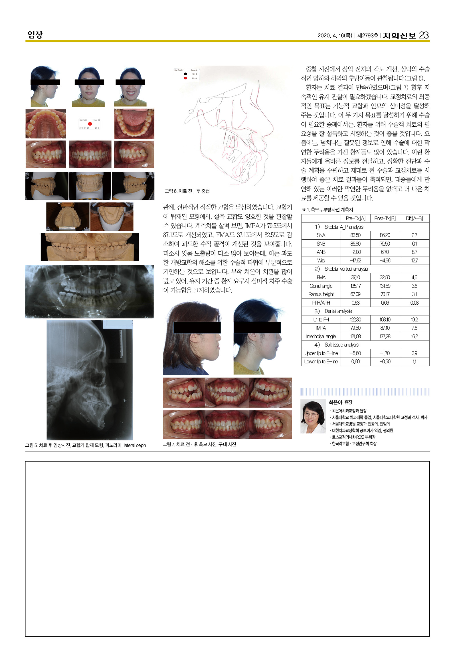 최은아2