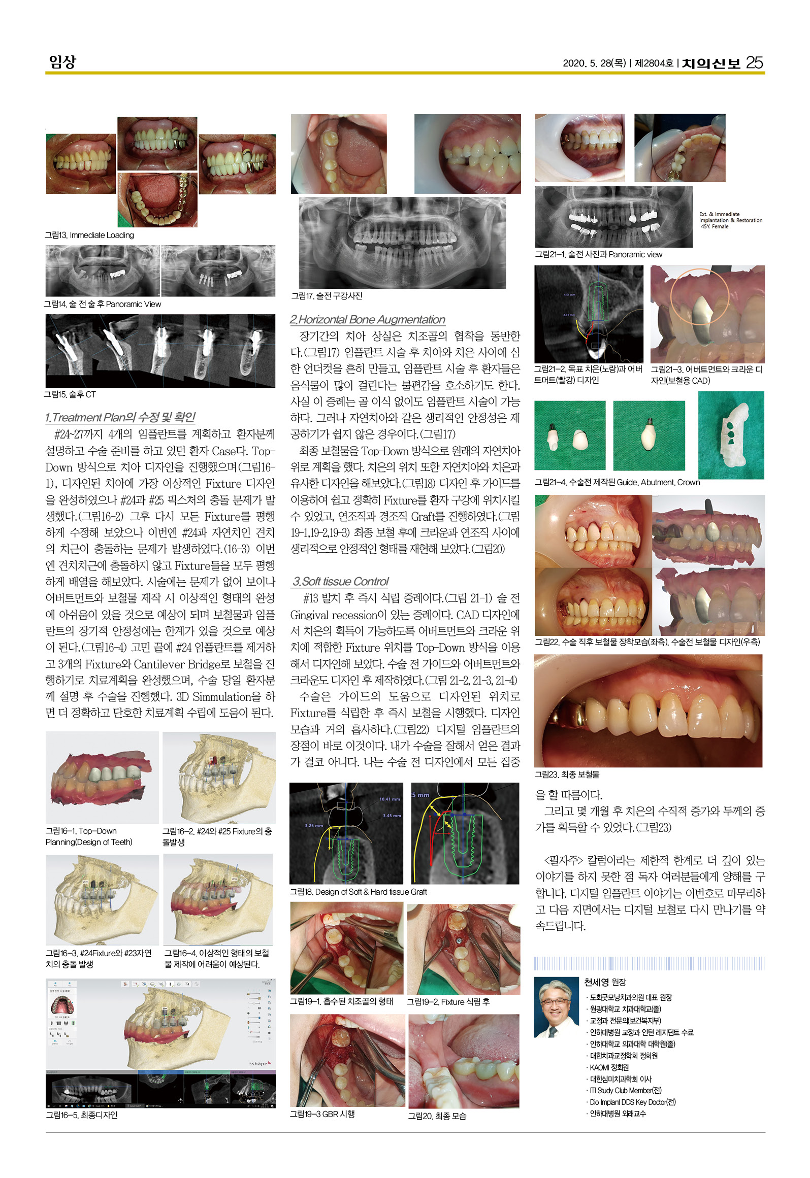 천세영32