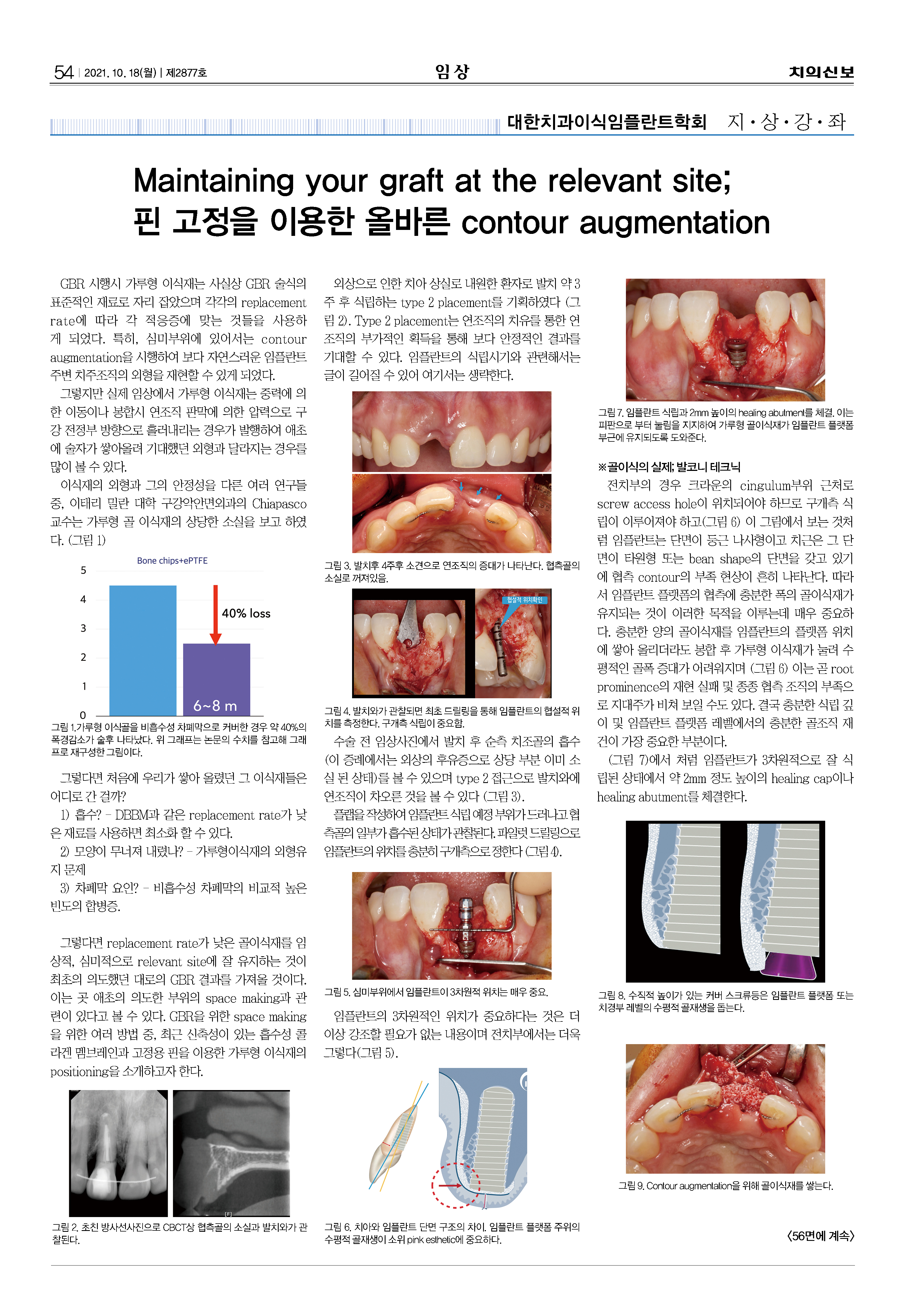 임상