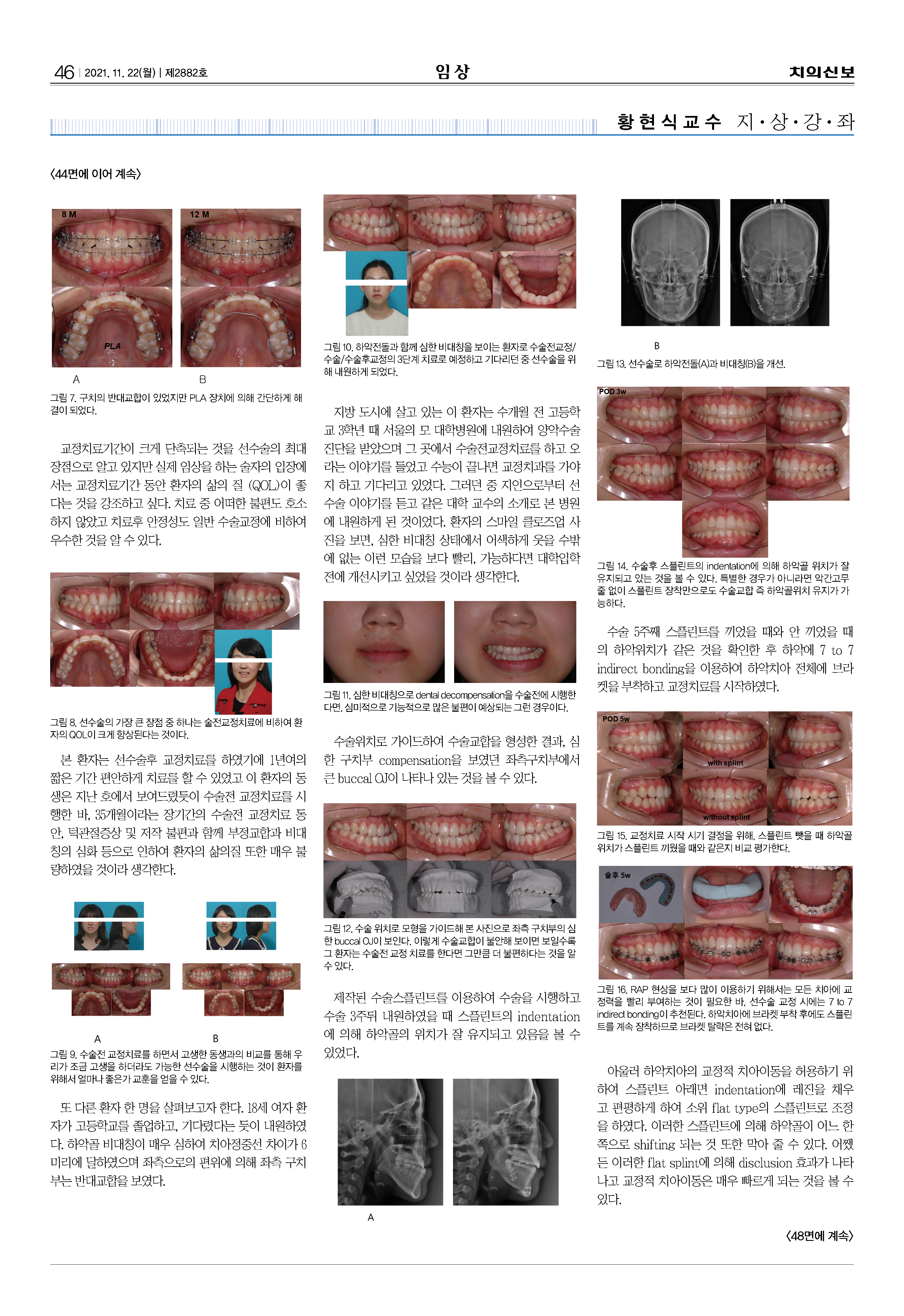 임상2