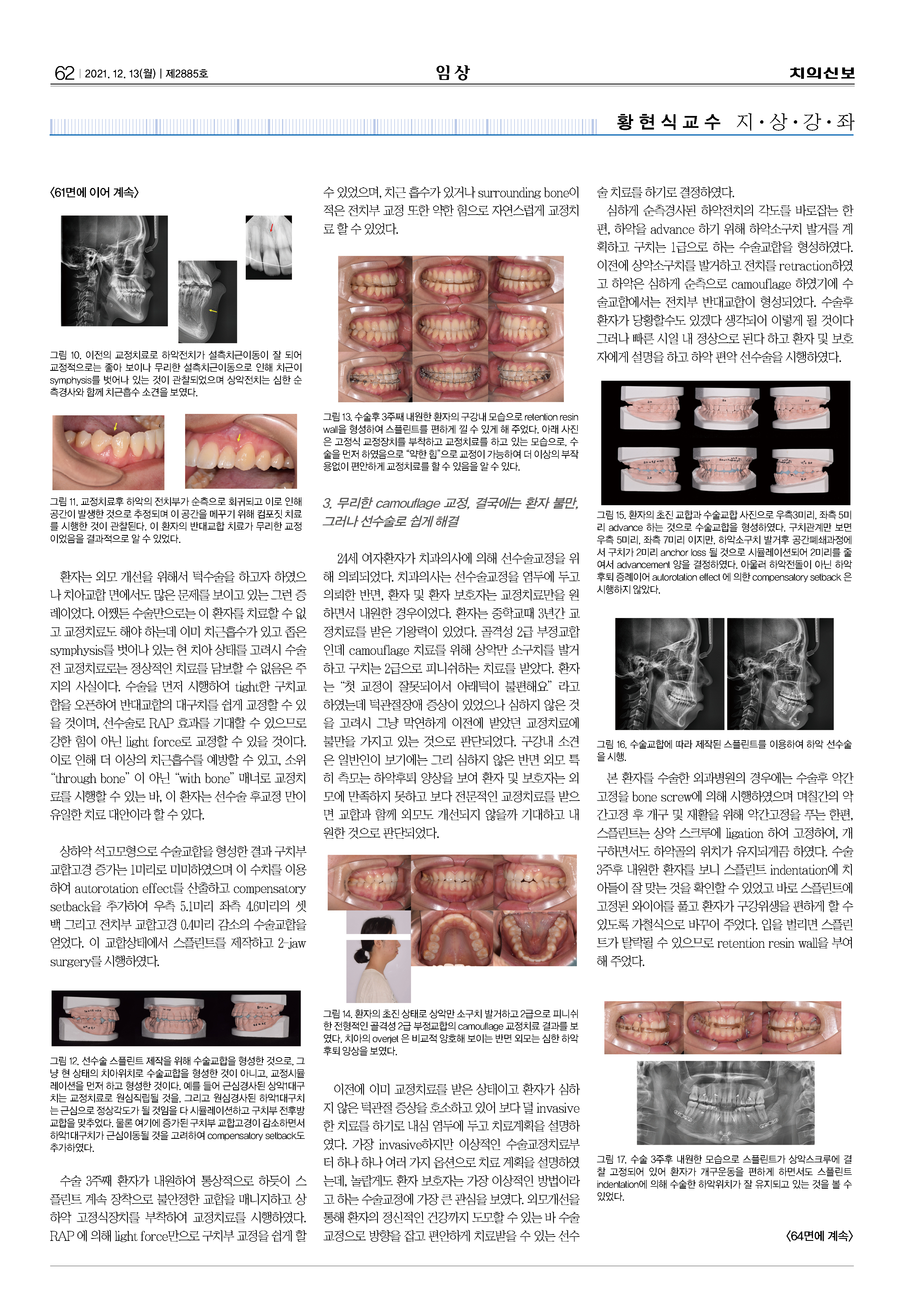 임상3