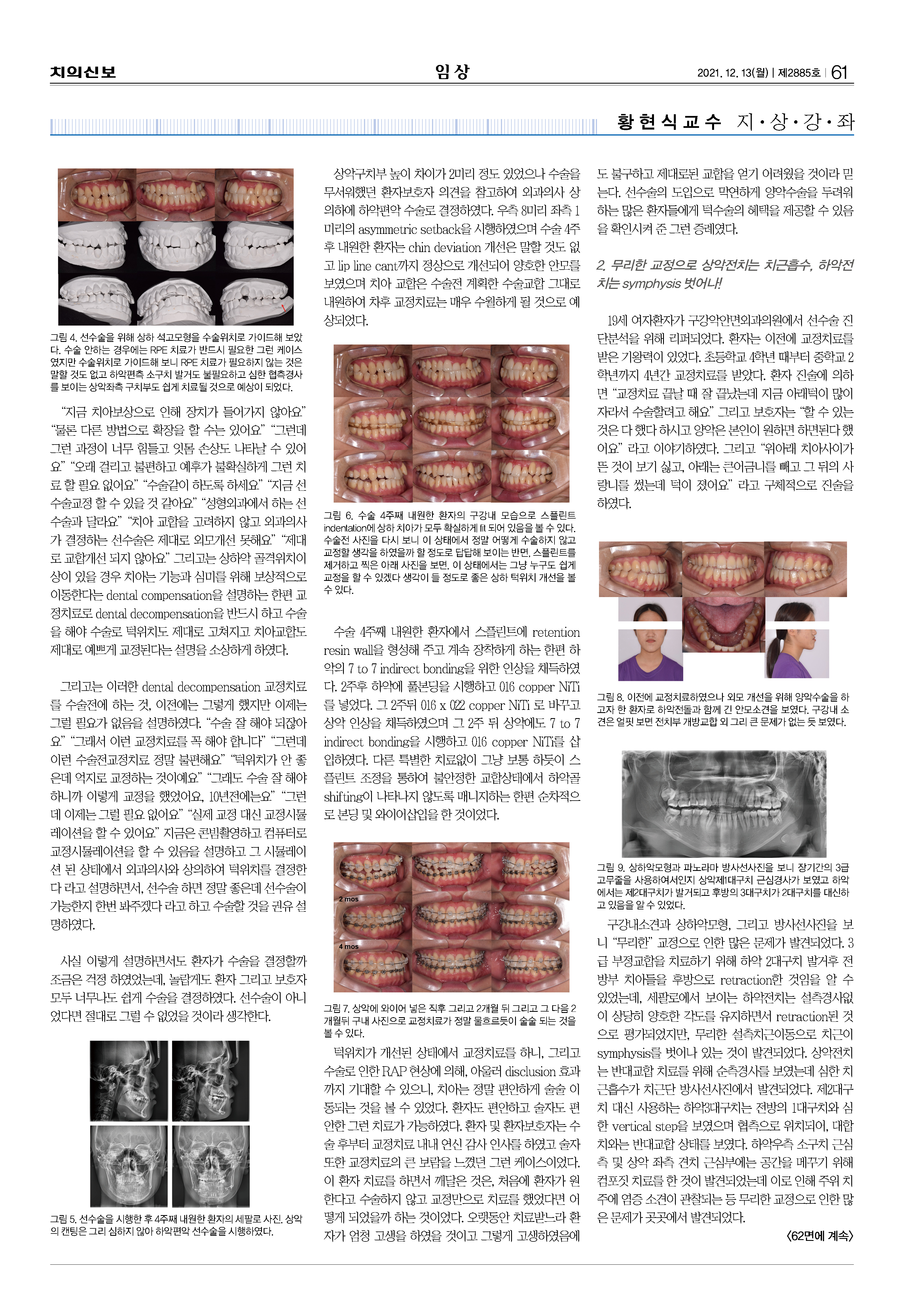 임상2