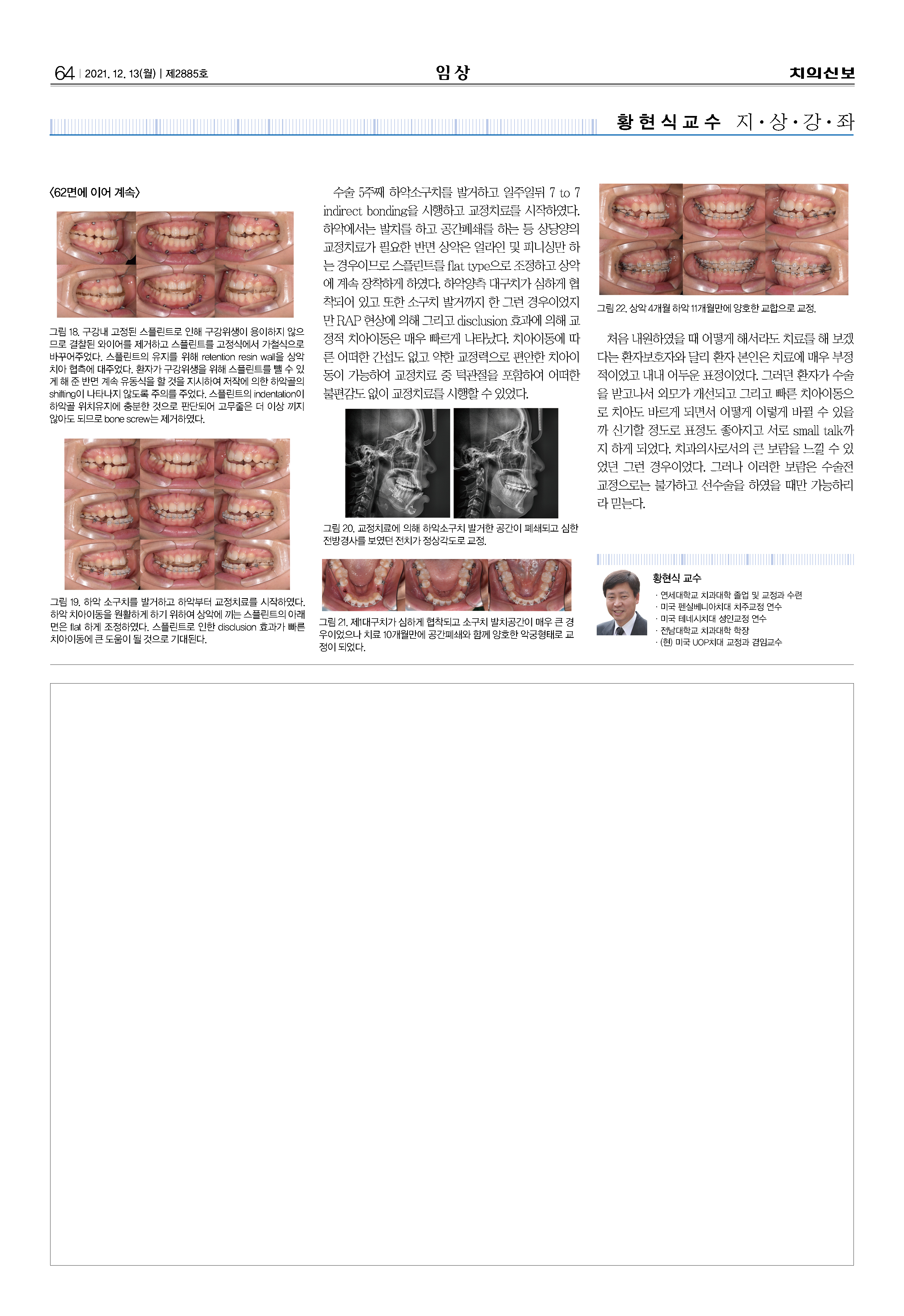 임상4