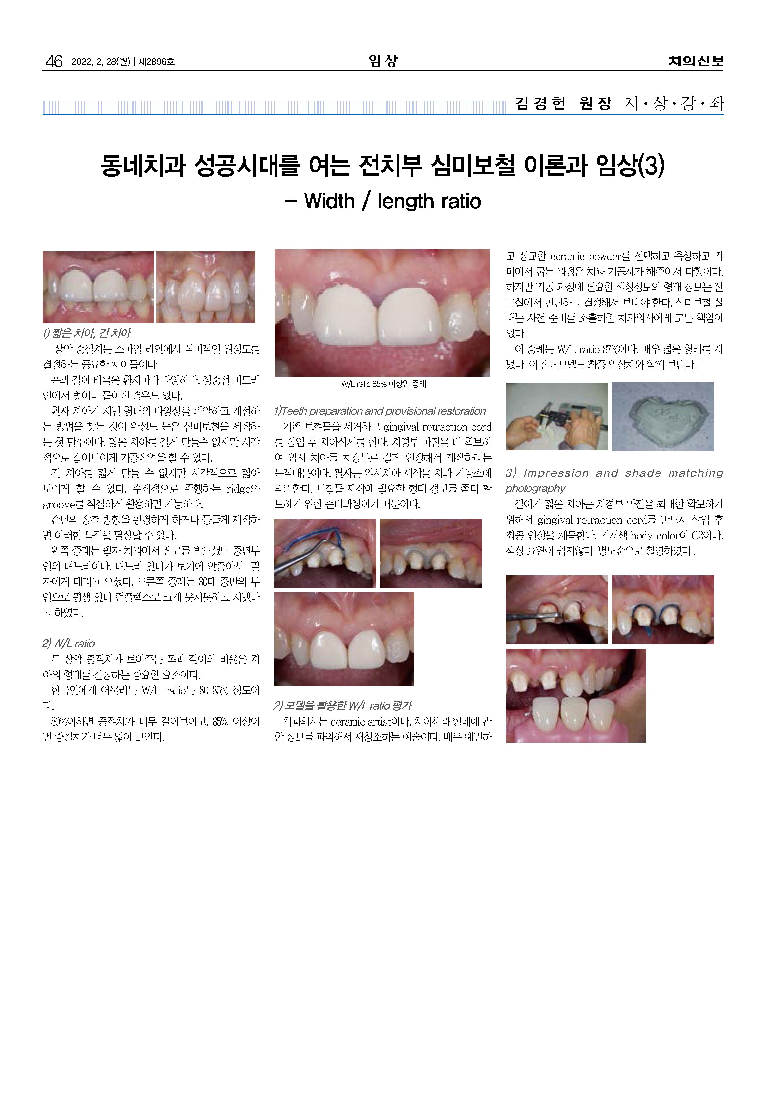 임상1