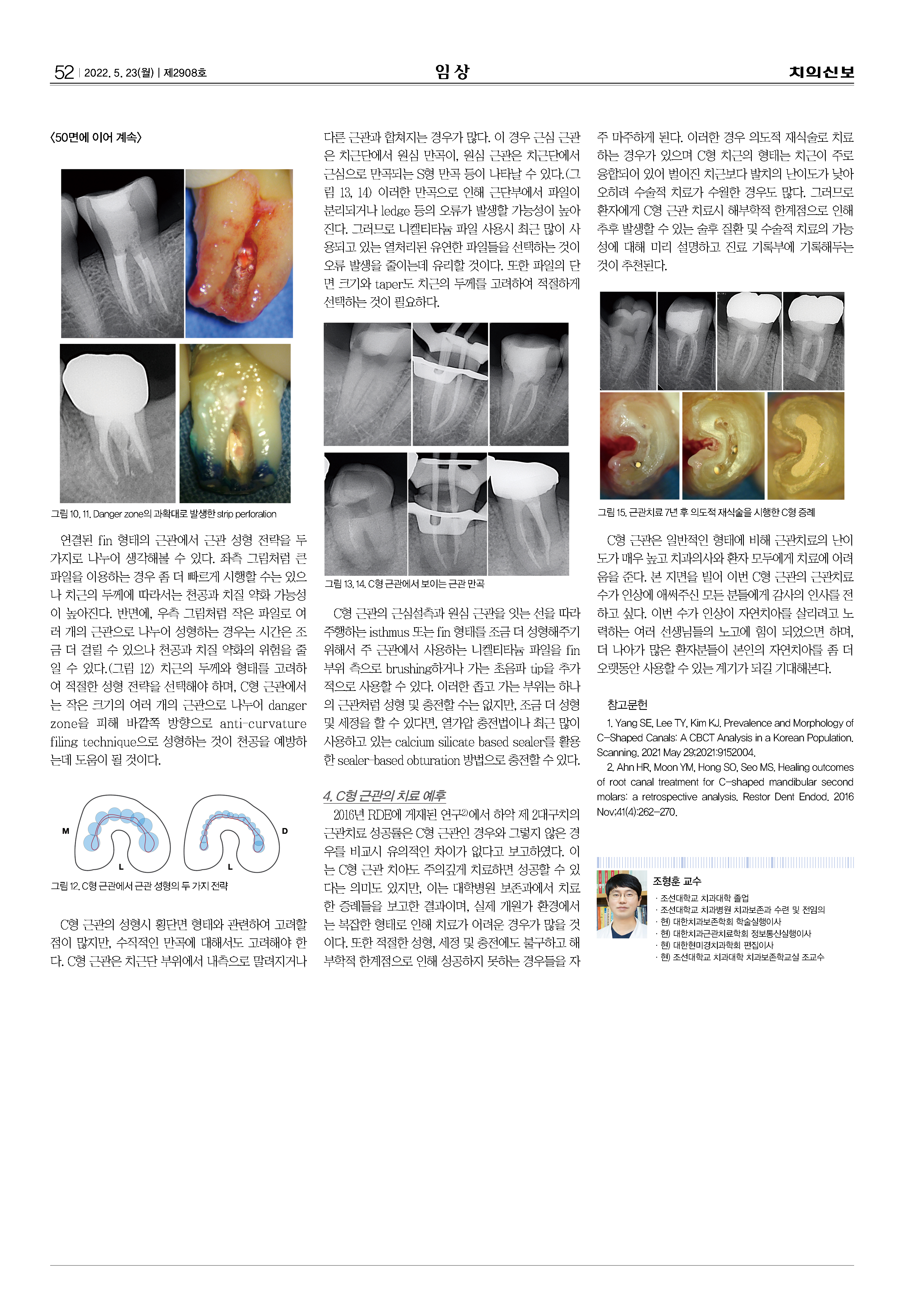 특별임상2