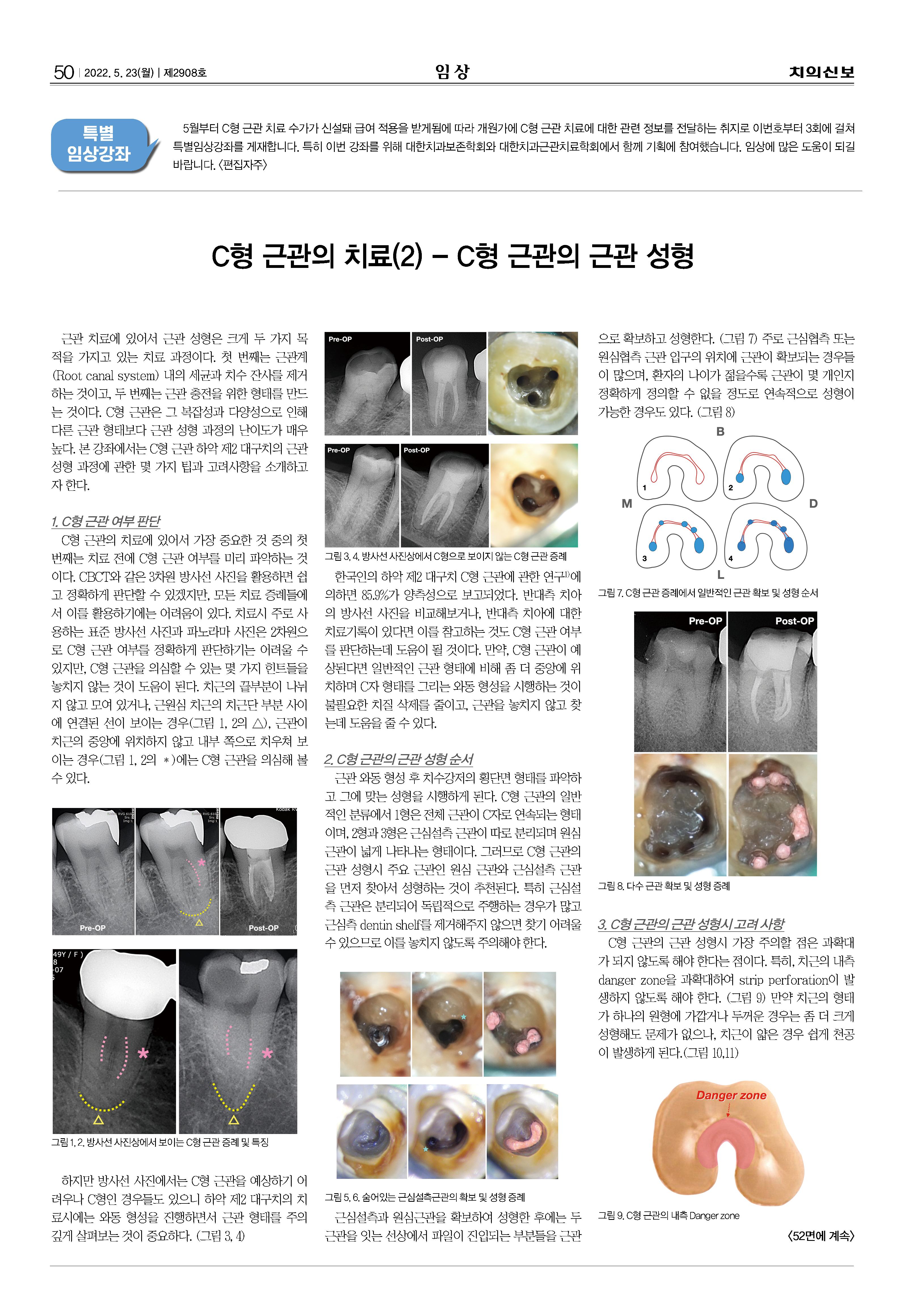 특별임상