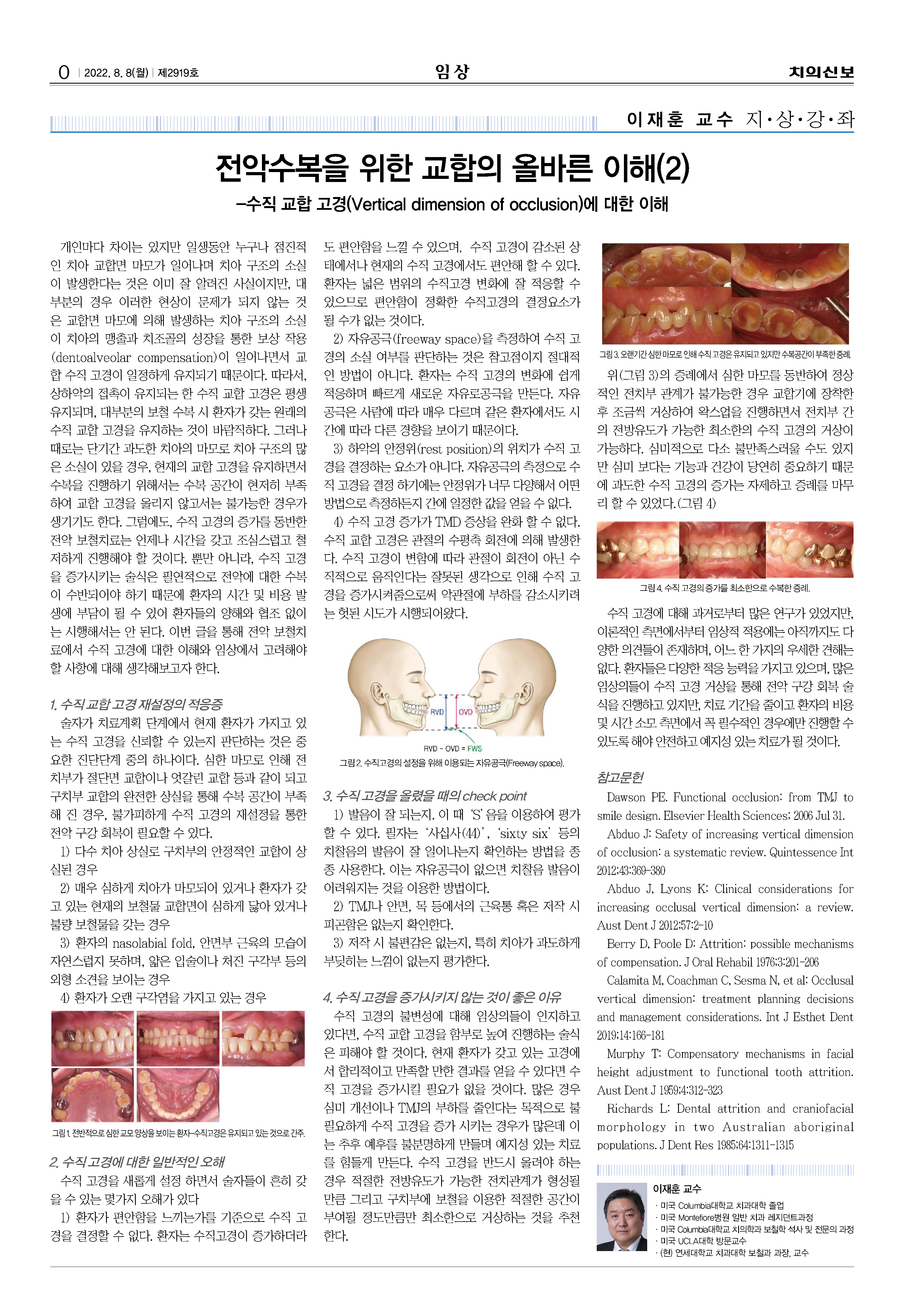 임상-이재훈