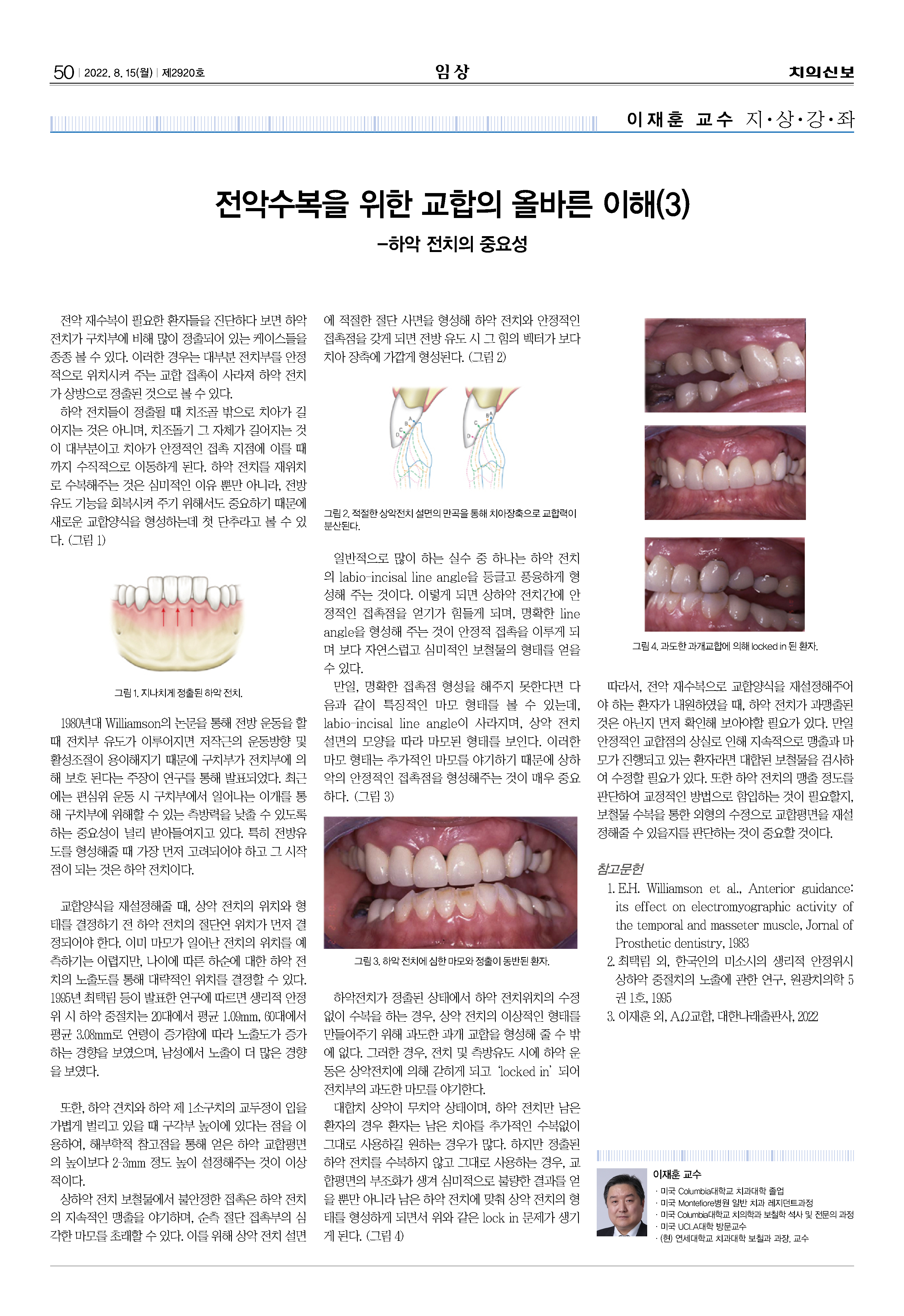 임상-이재훈