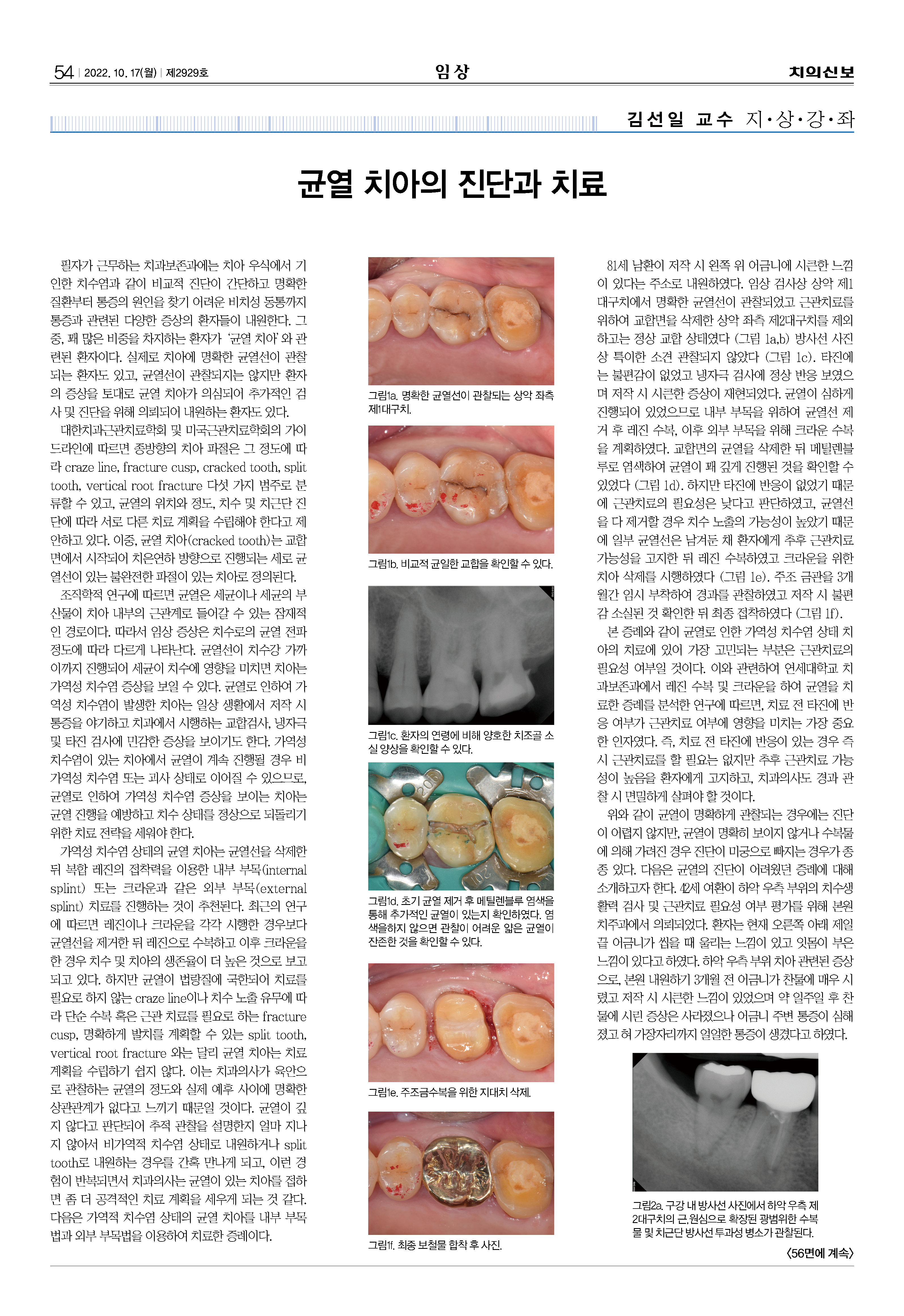 임상1