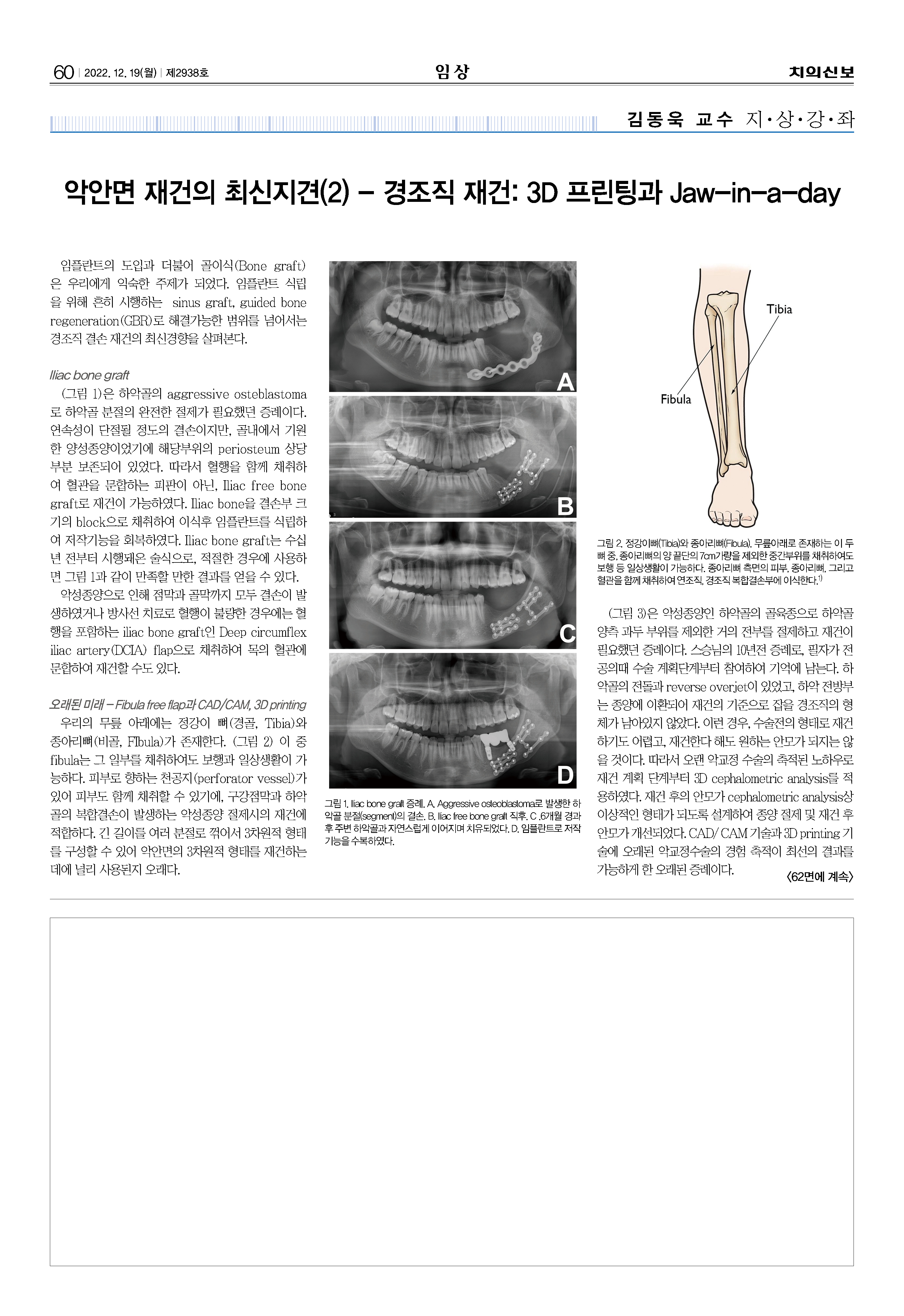 임상1