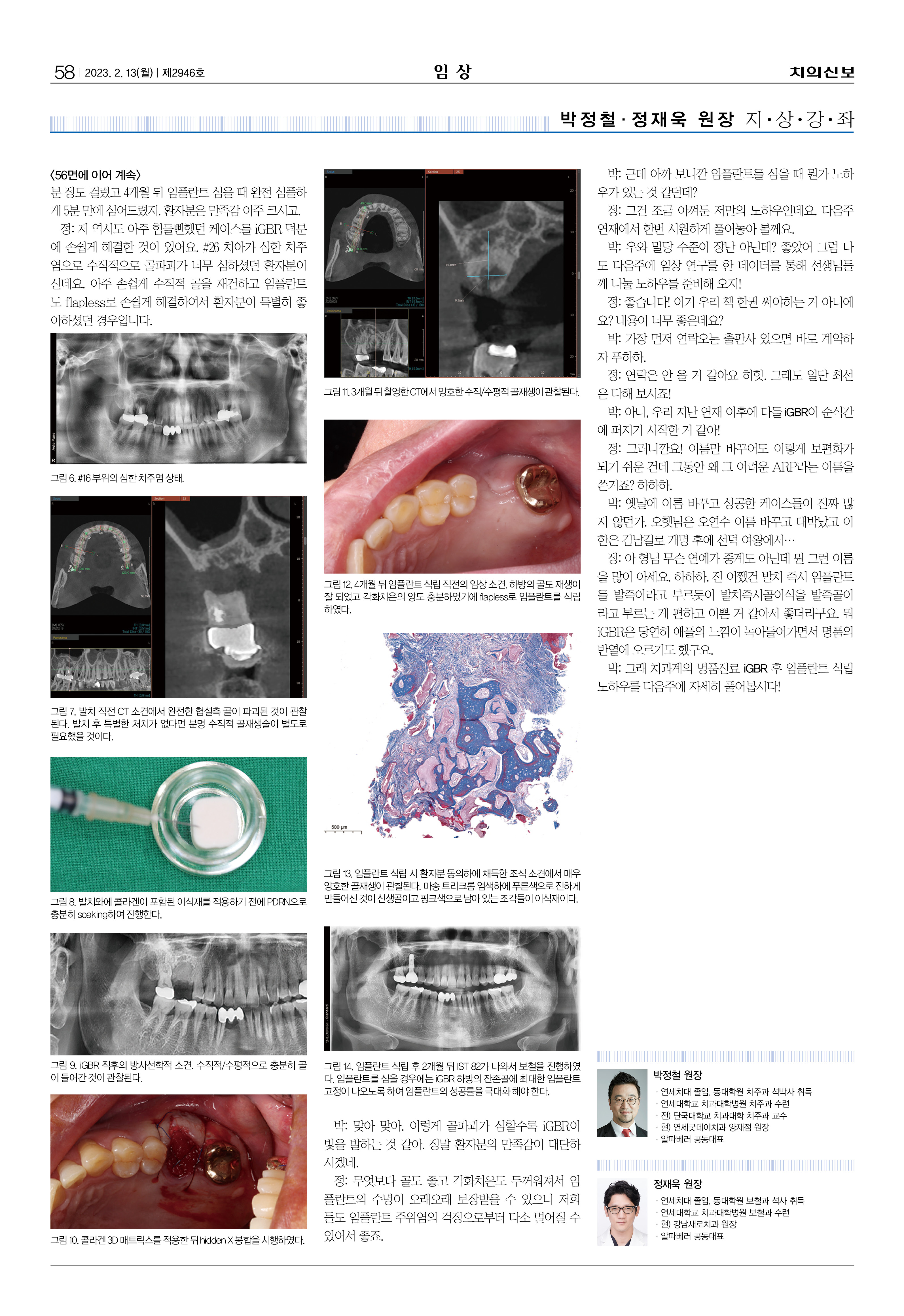 임상2