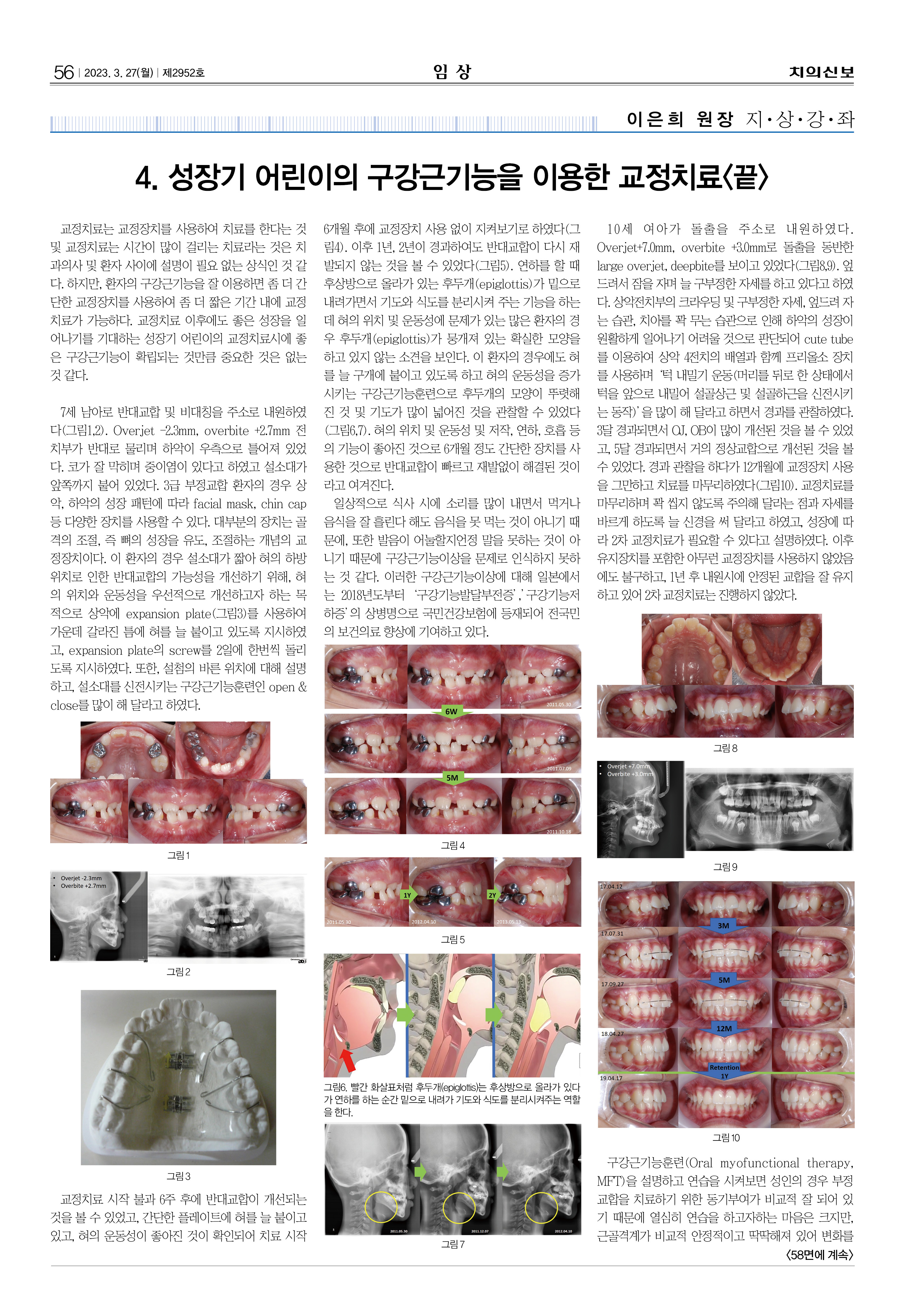 임상1