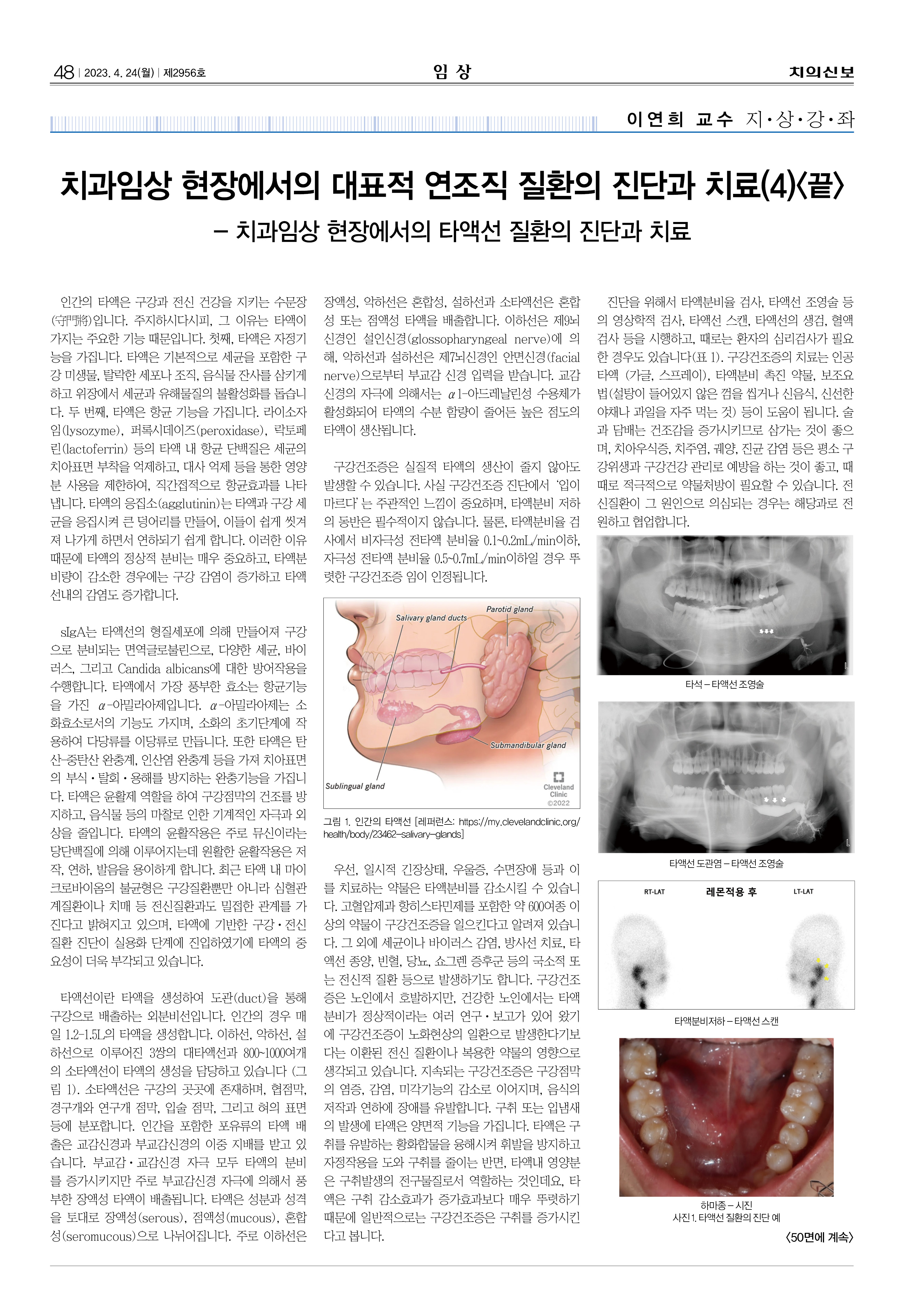 임상1