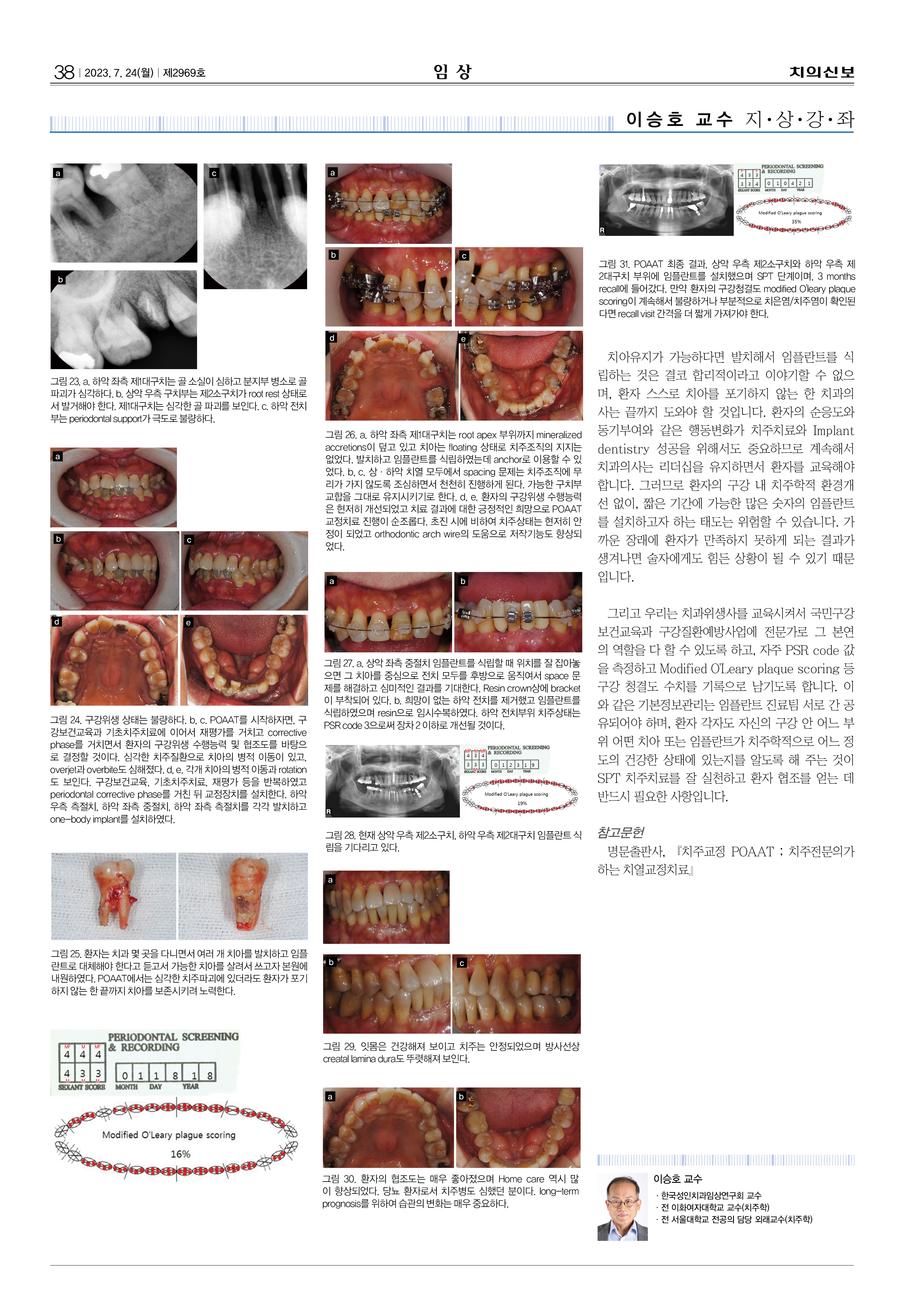 임상-3