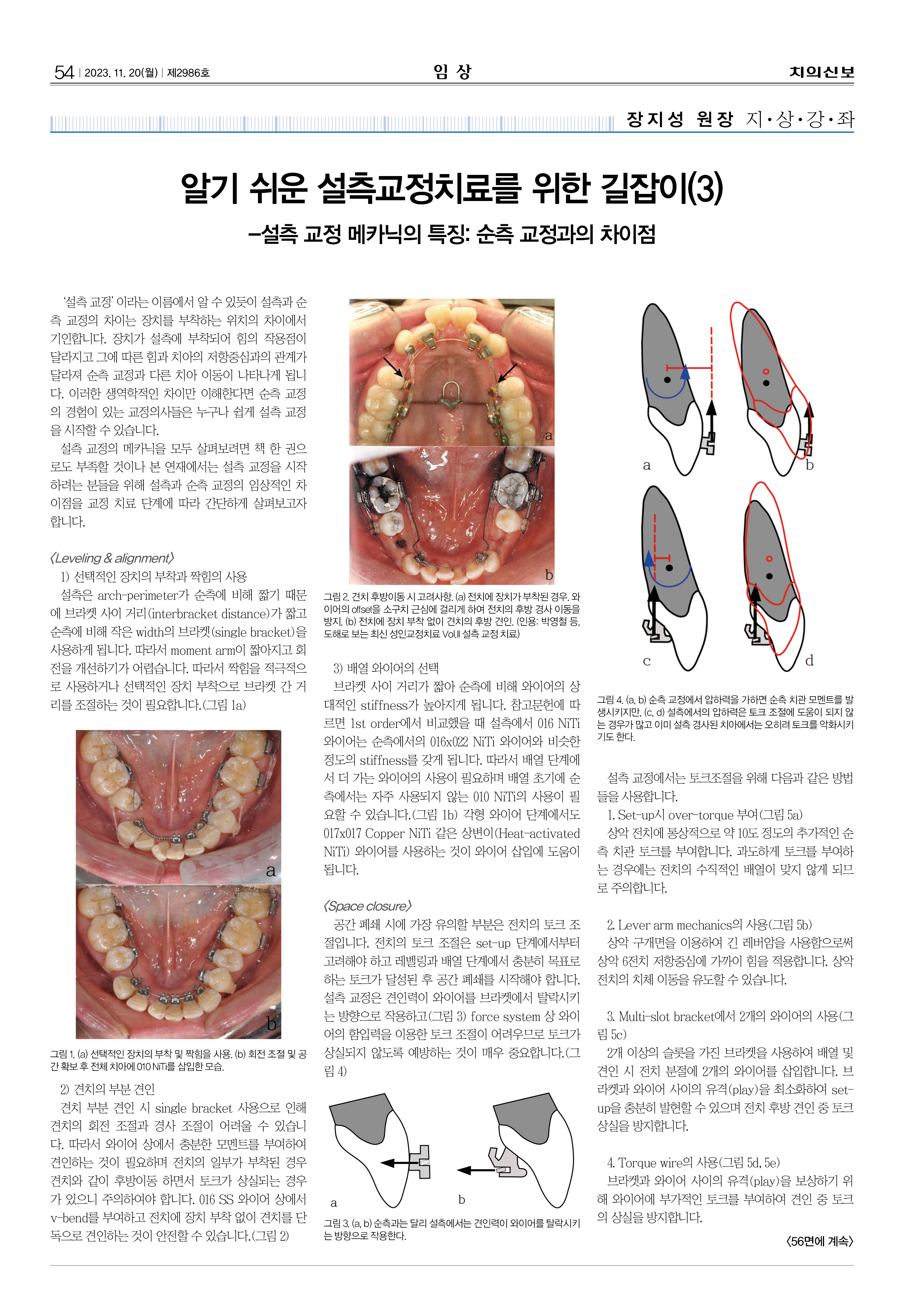 임상-1