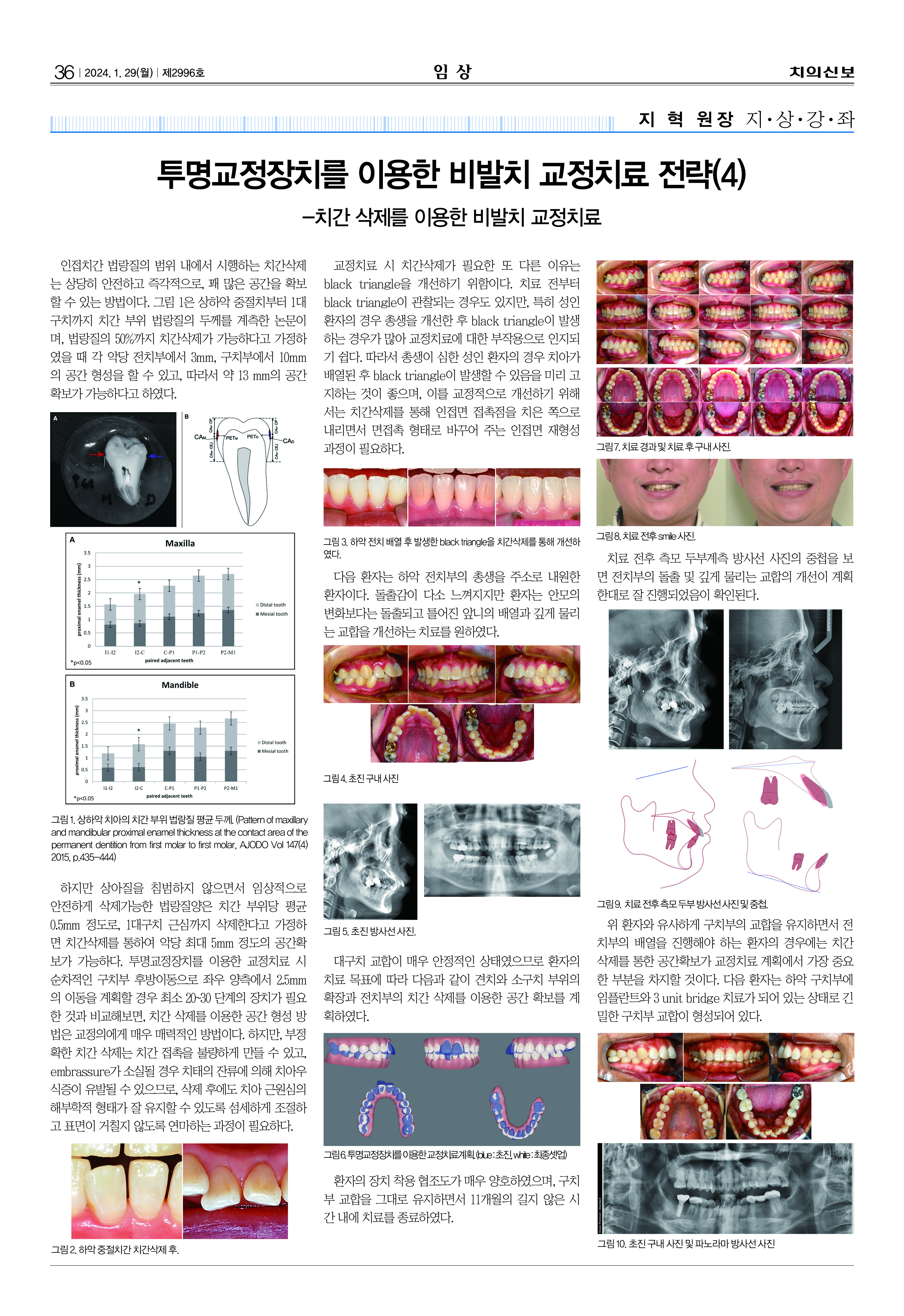 임상-1