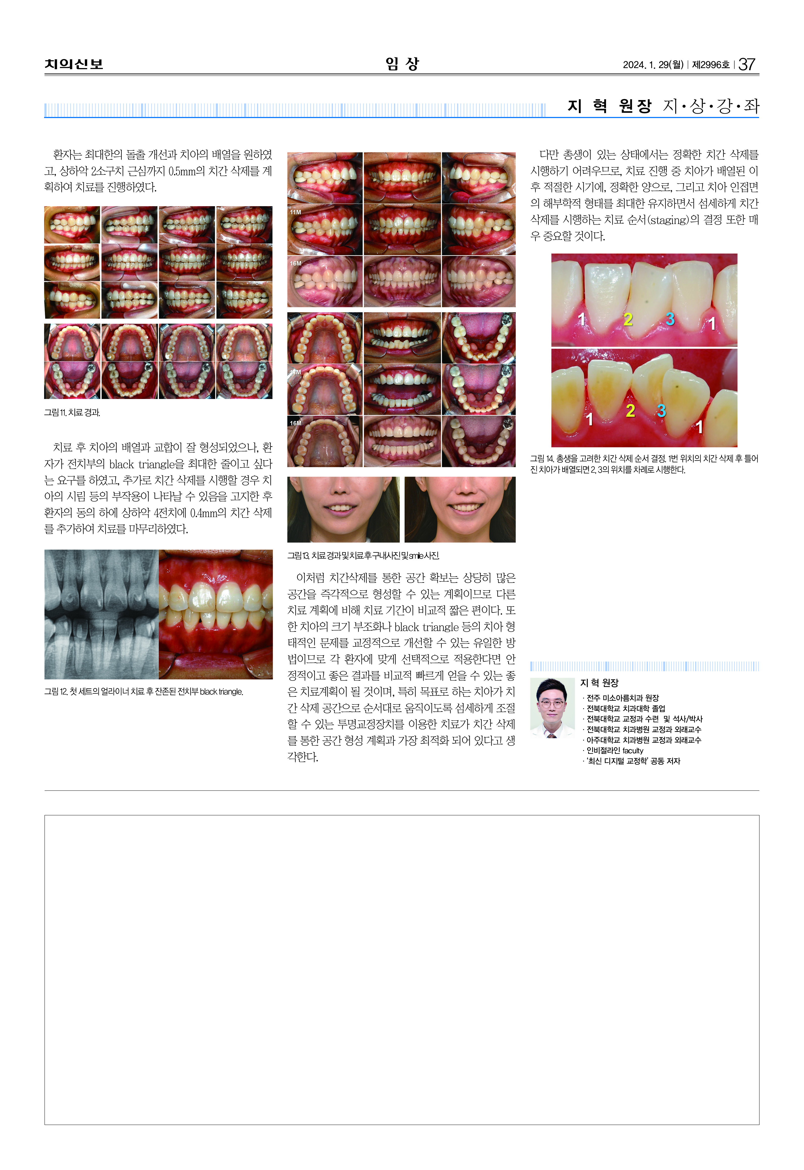 임상-2