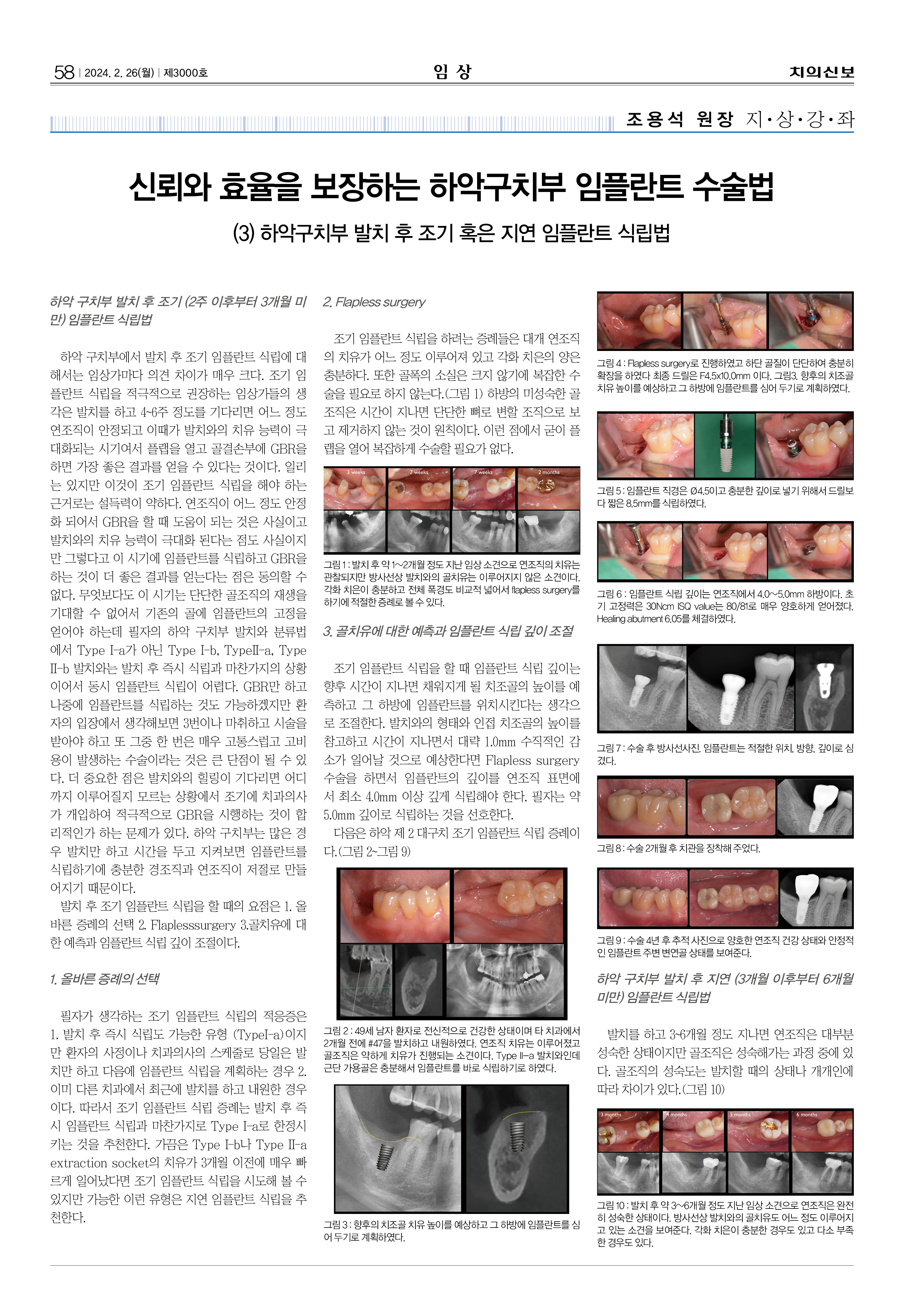 58,60_CG_0221_임상-조용석3