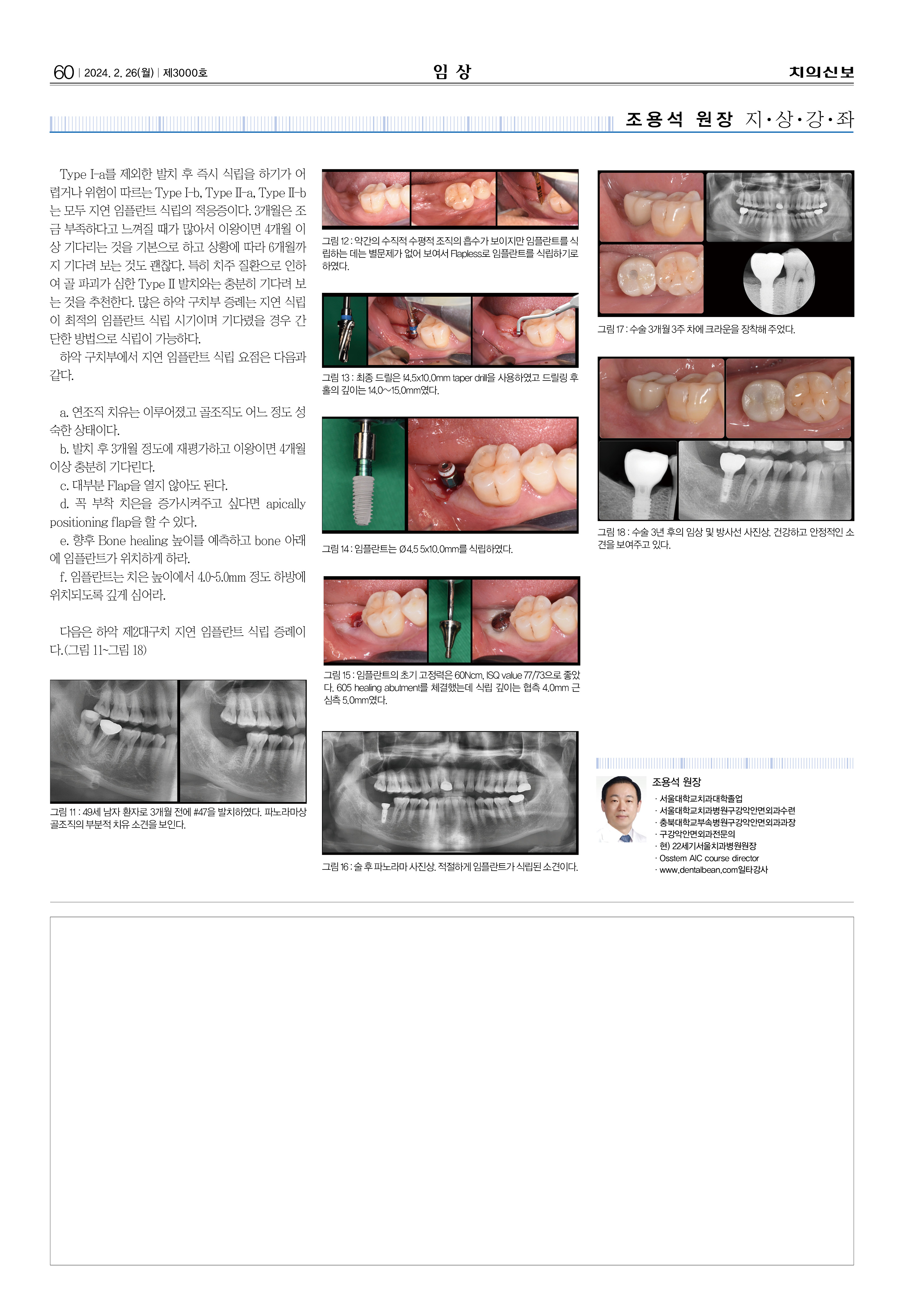 58,60_CG_0221_임상-조용석32