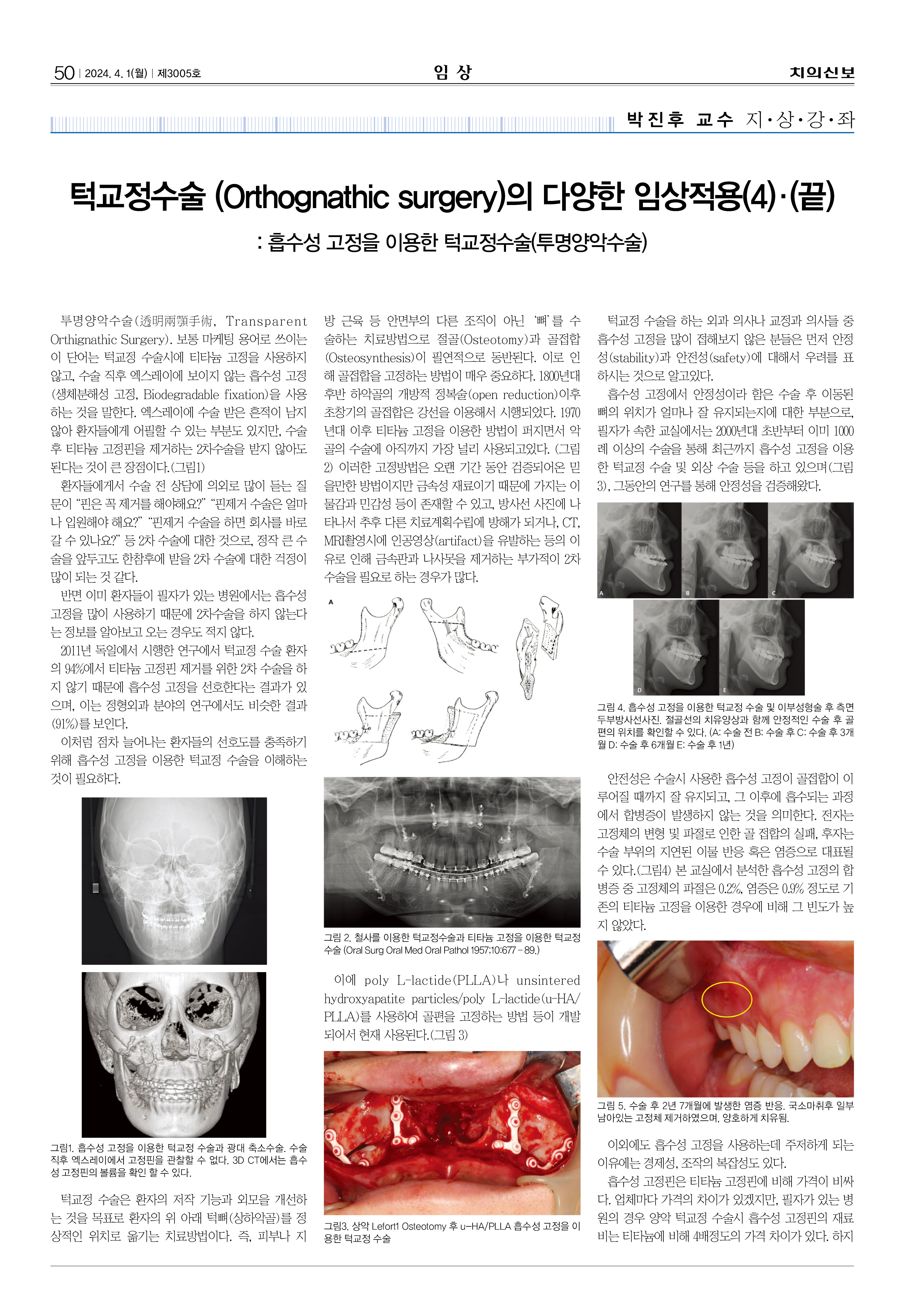 임상1수정