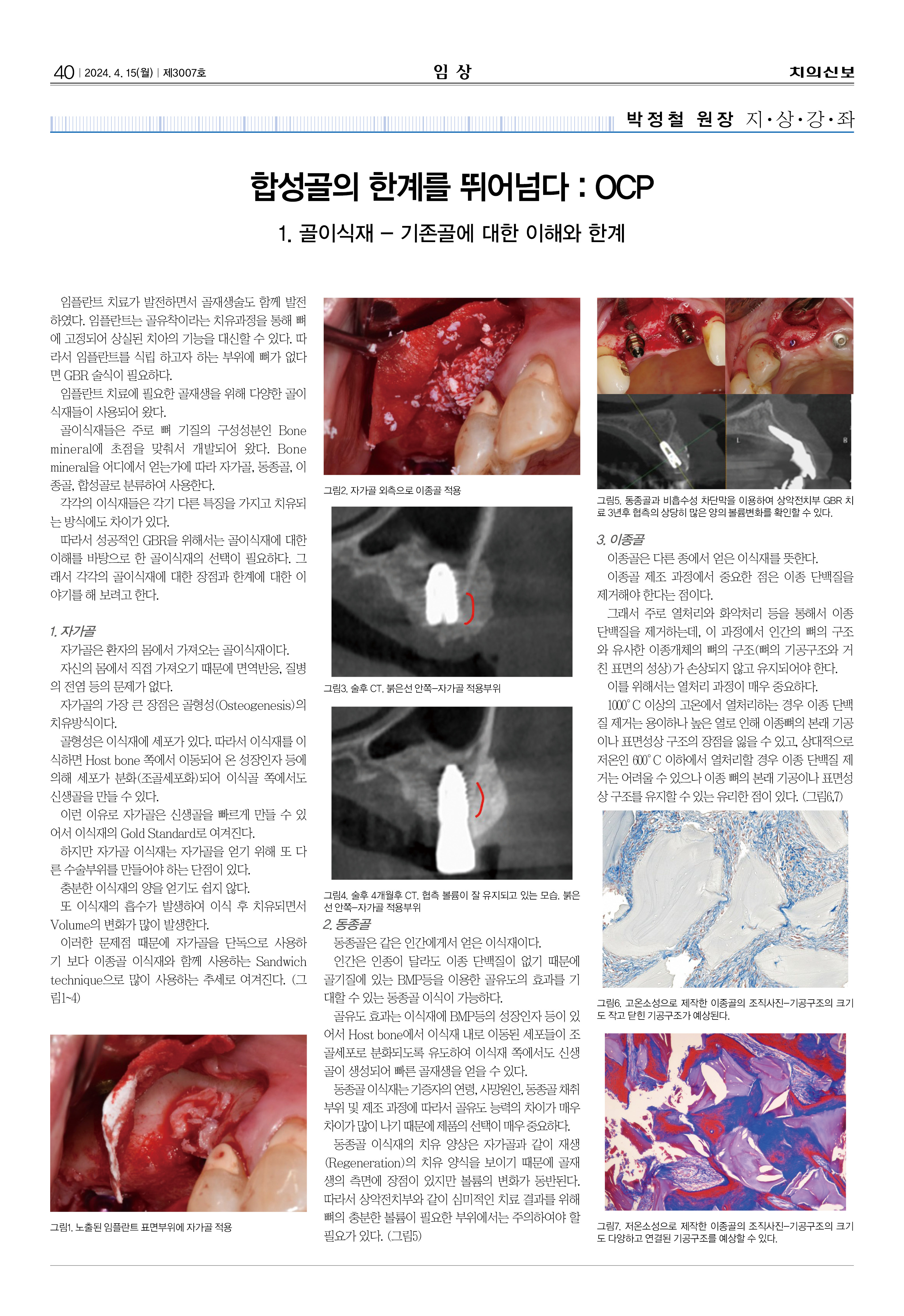 임상-1