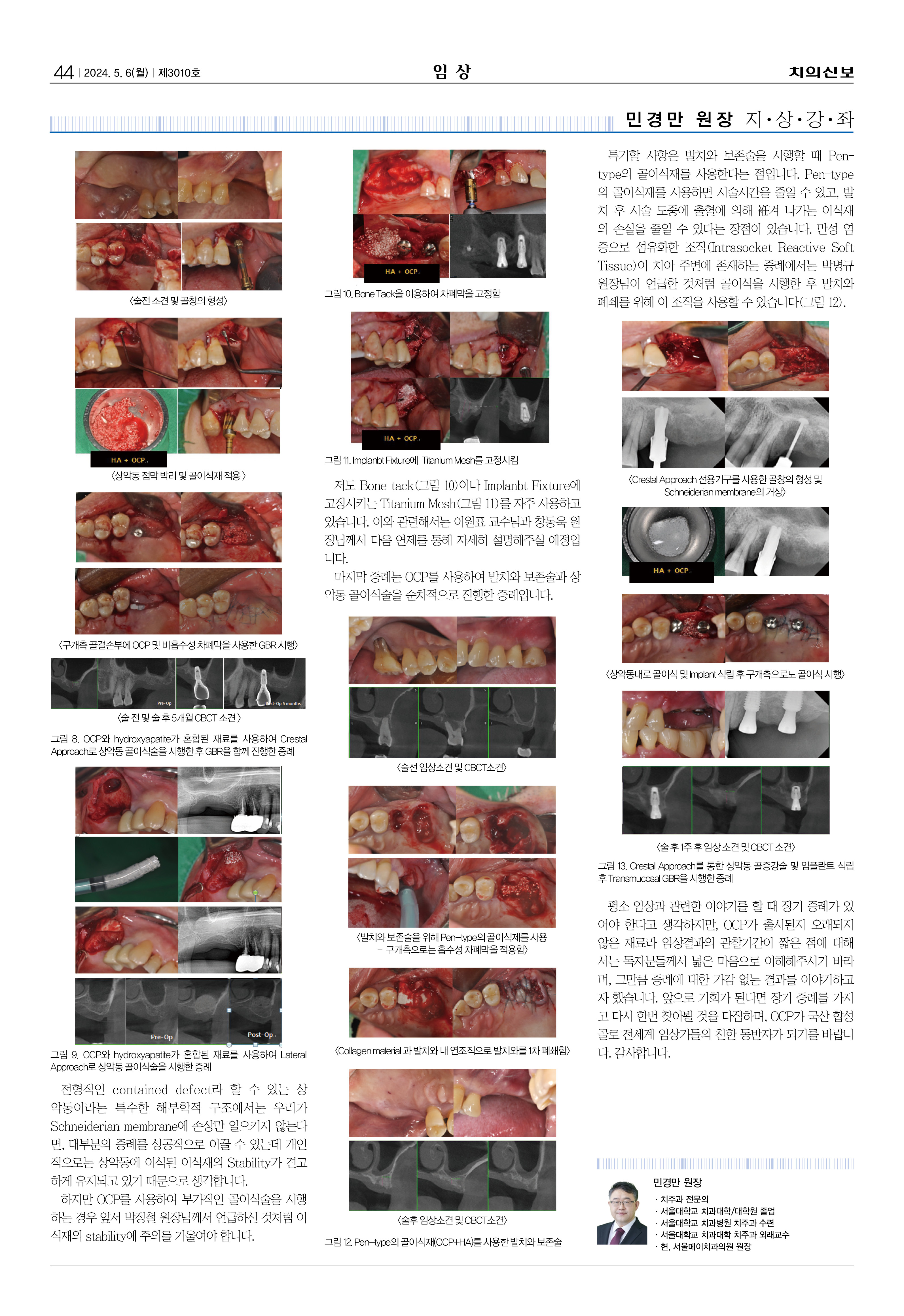임상2