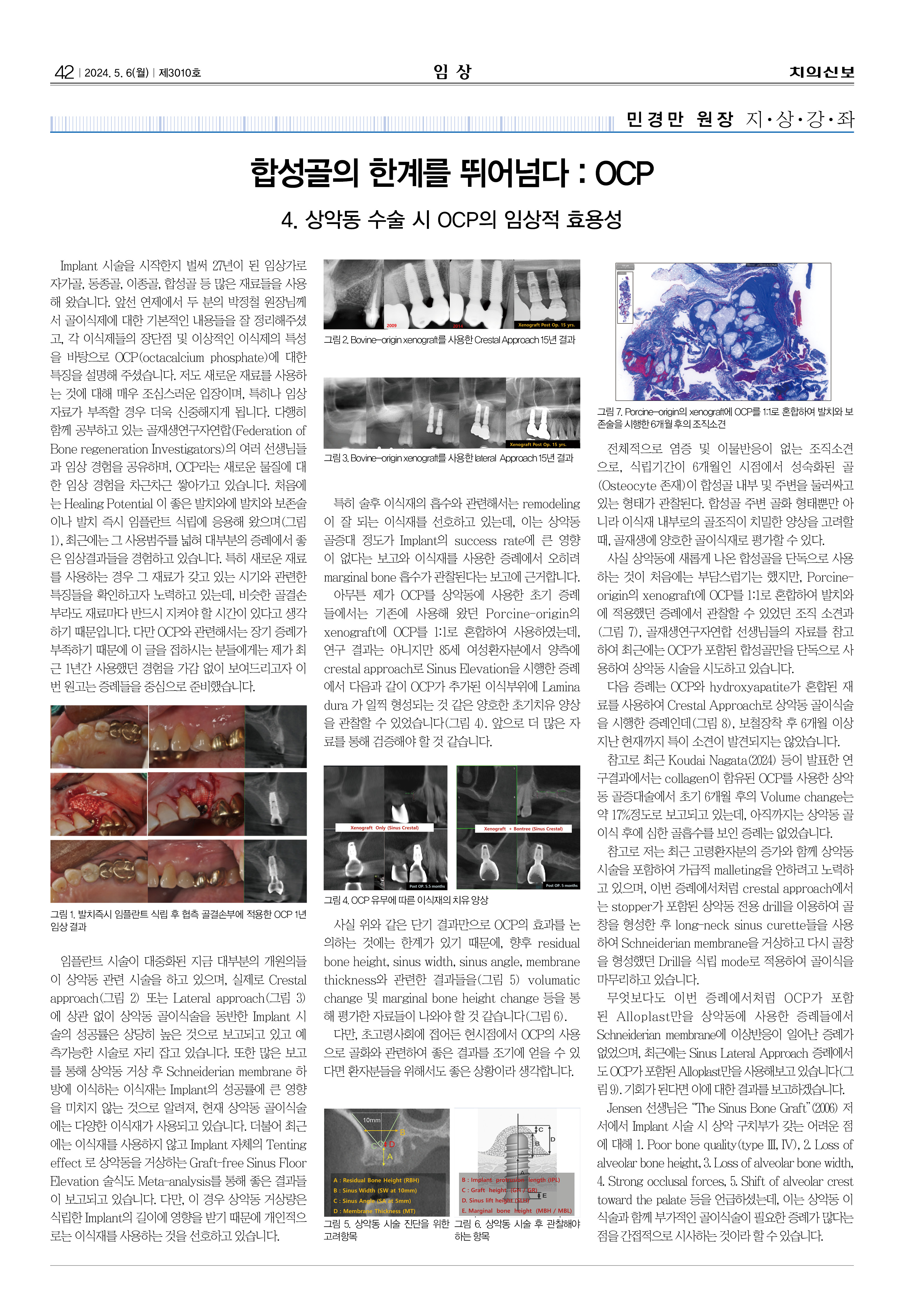 임상1