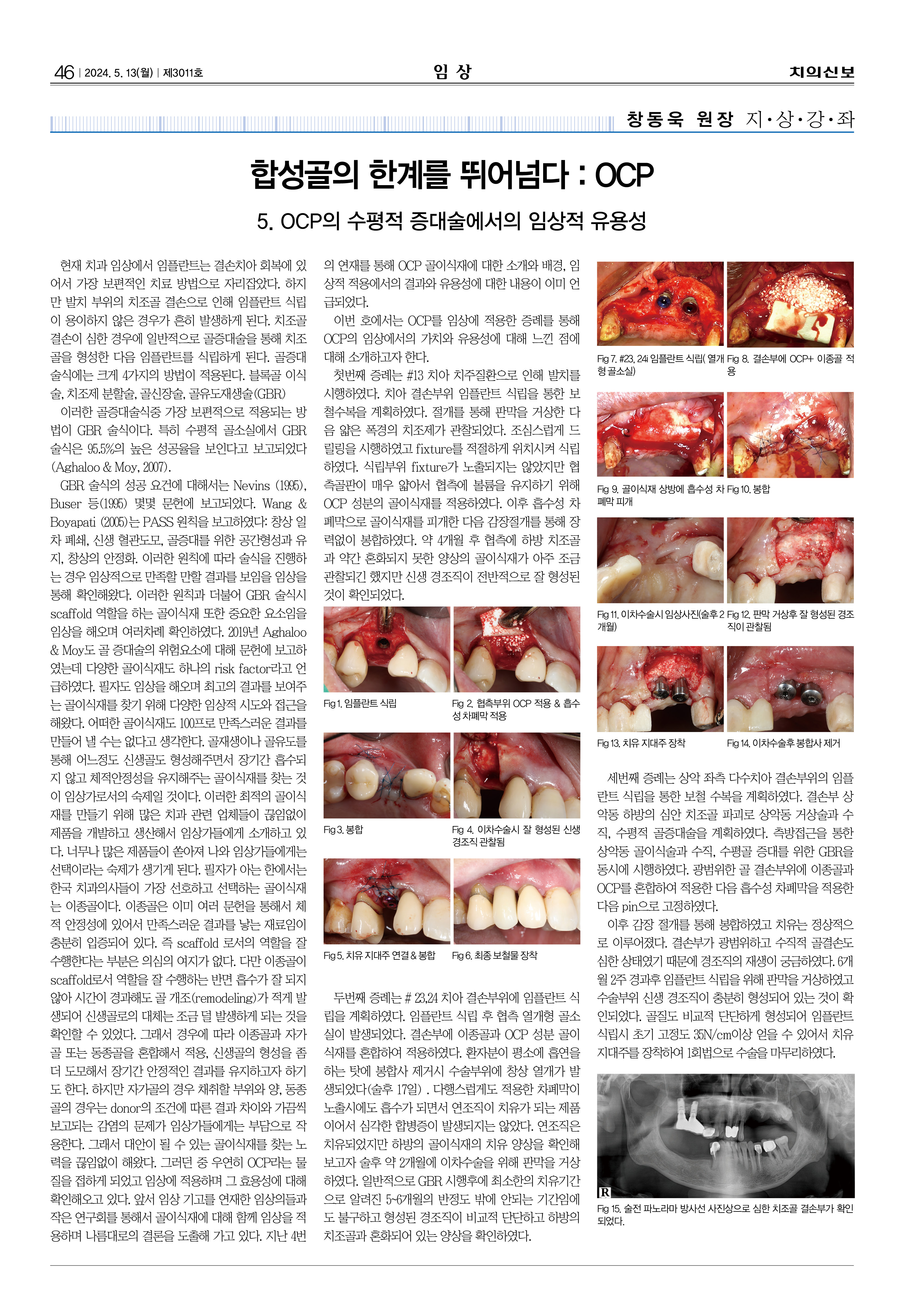 임상1