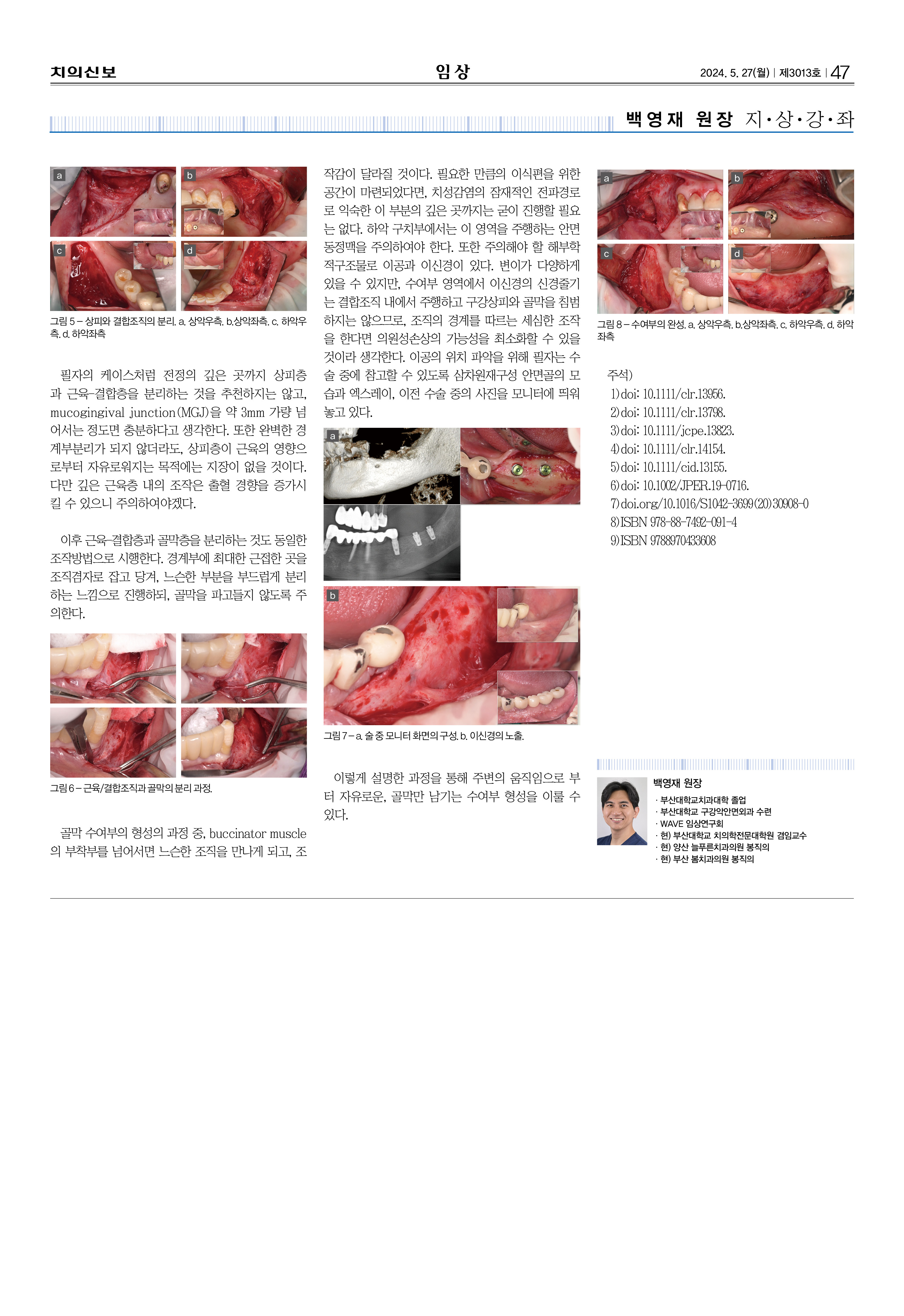 임상2