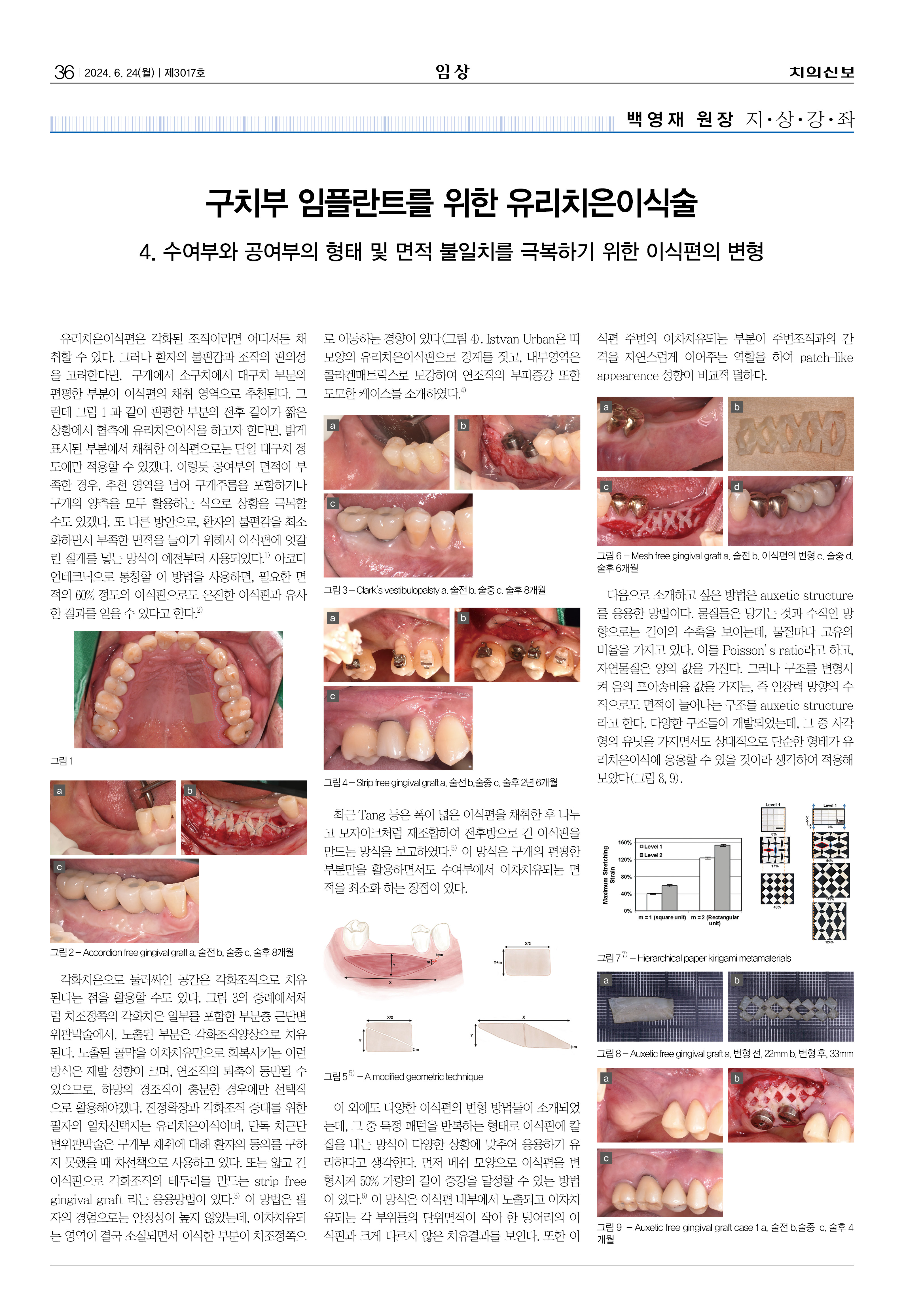 임상1
