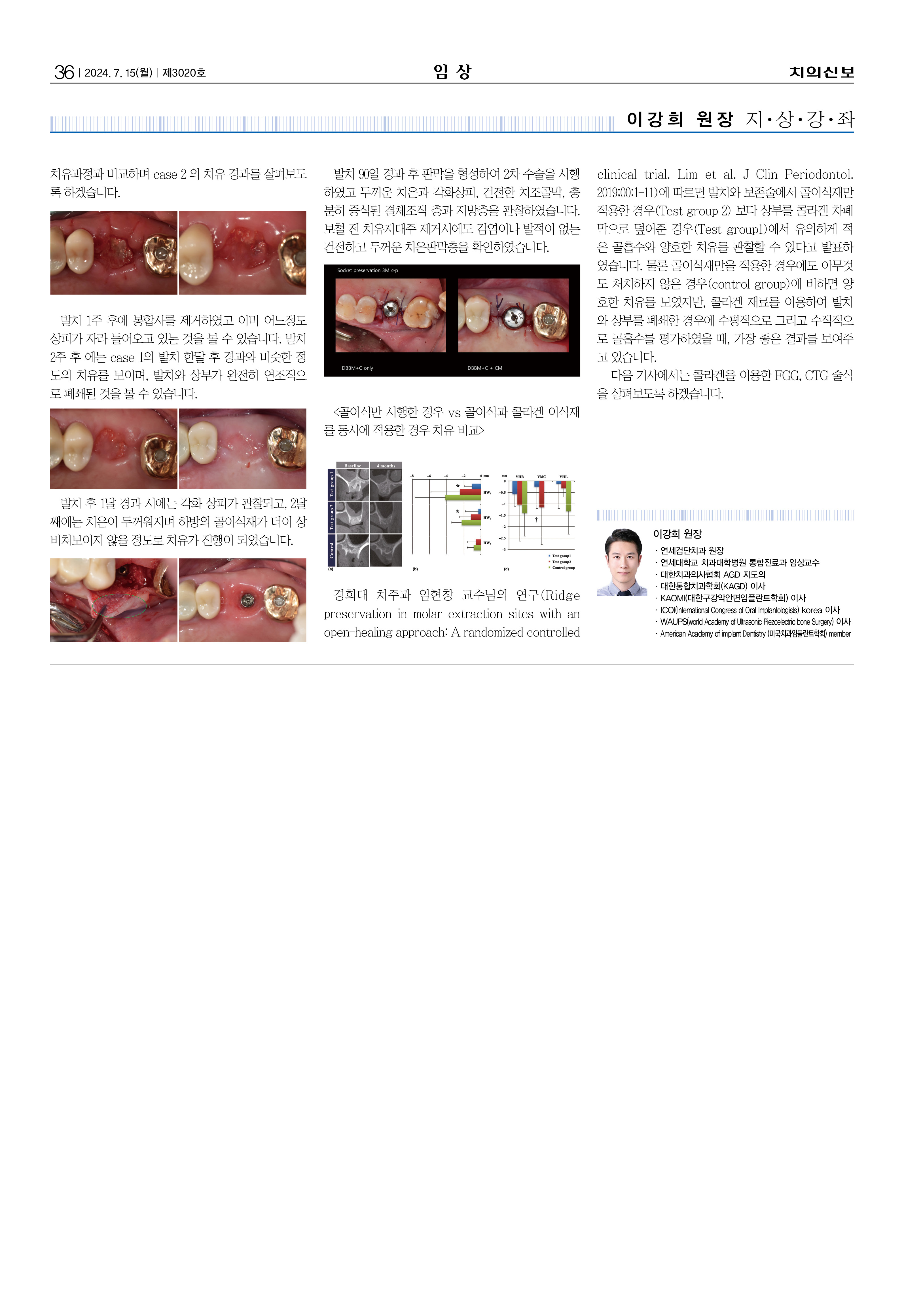 임상2