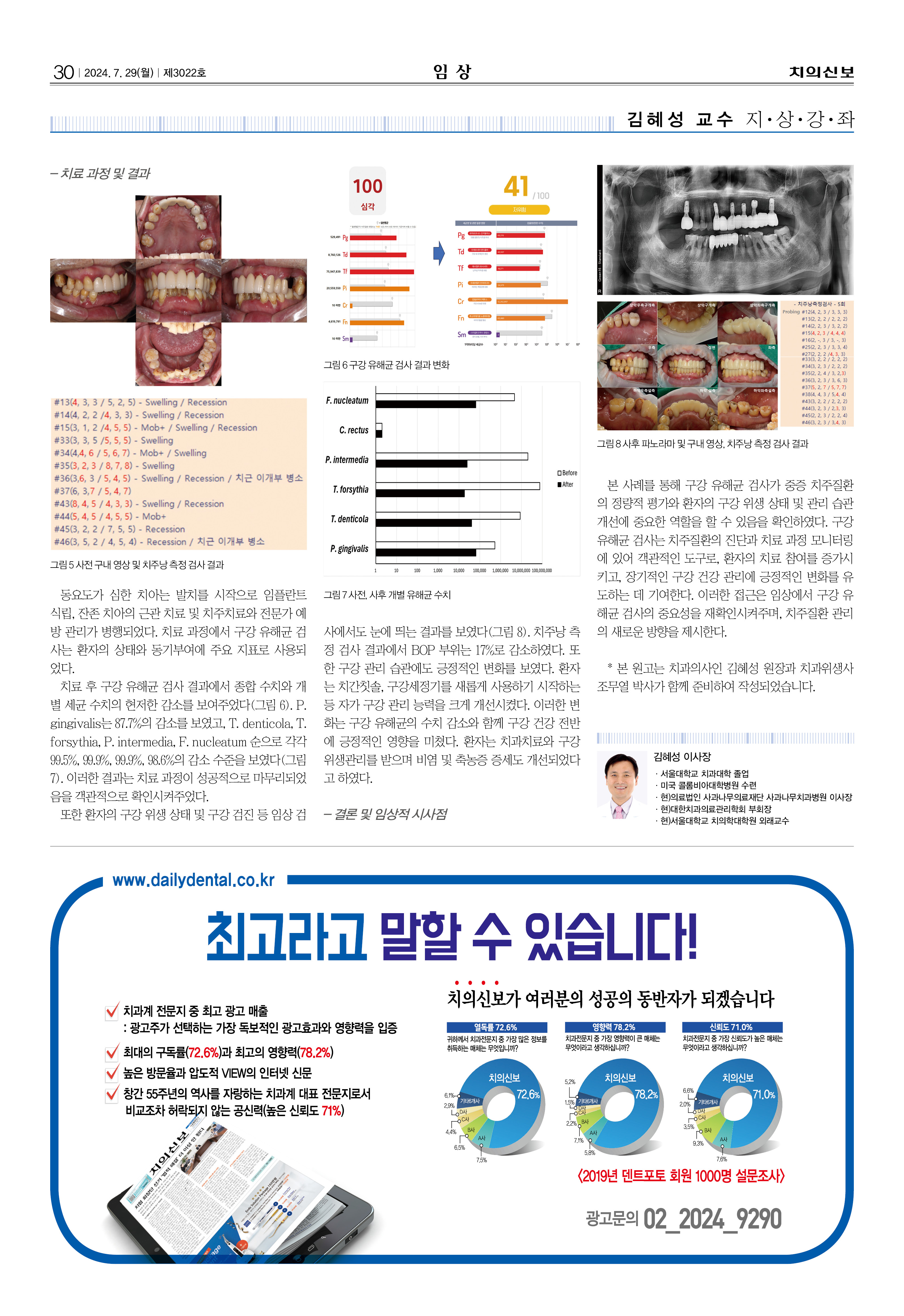 임상2