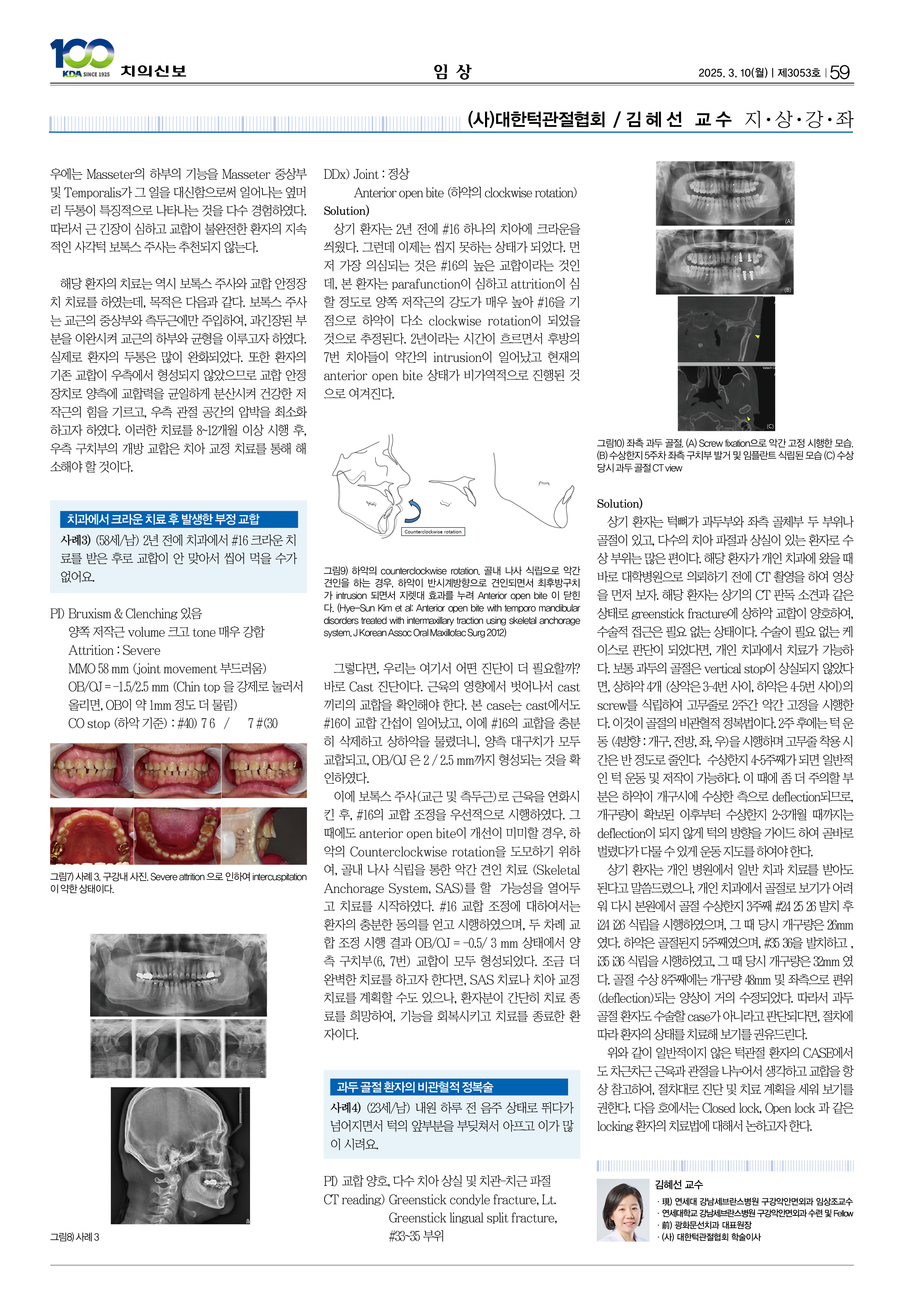 59_CG_0305_임상