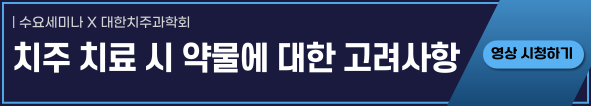 배너